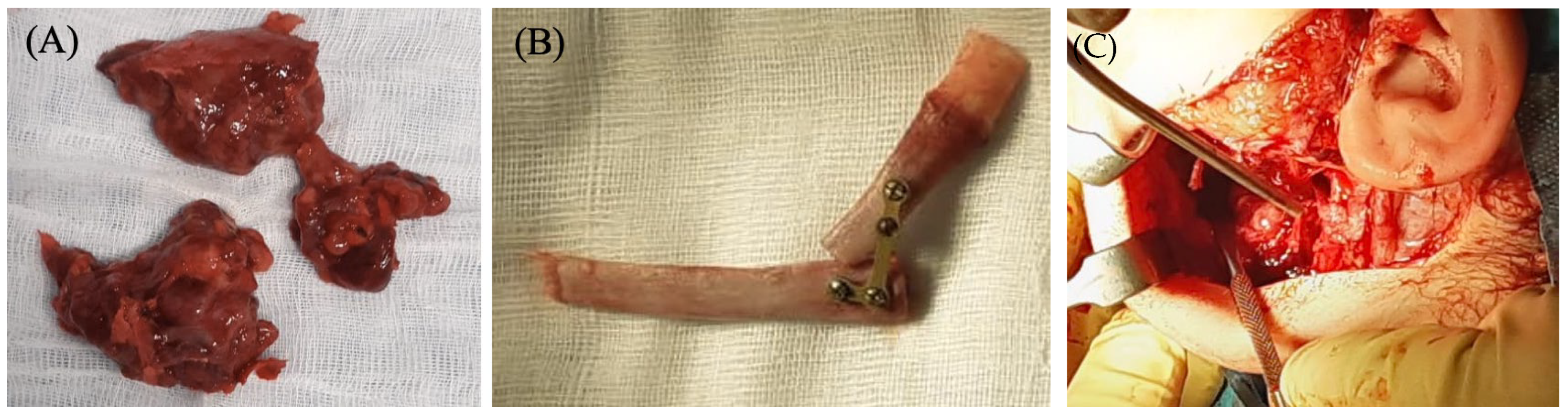 Surgeries 06 00102 g002