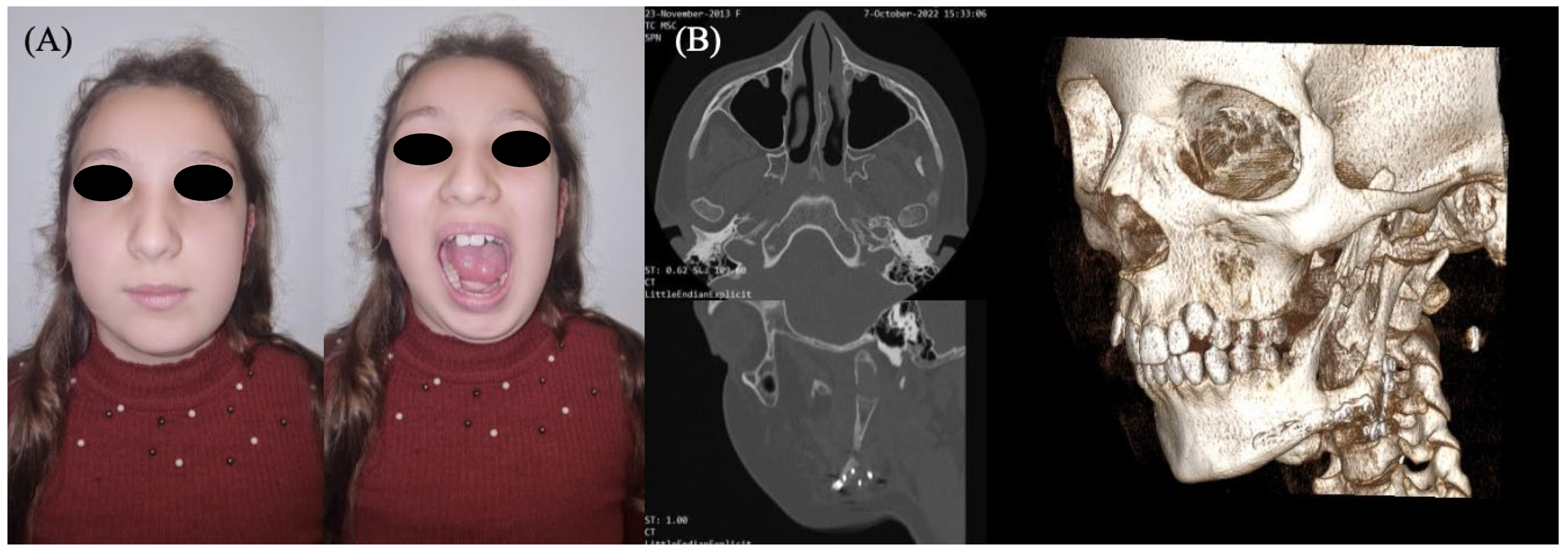Surgeries 06 00102 g004