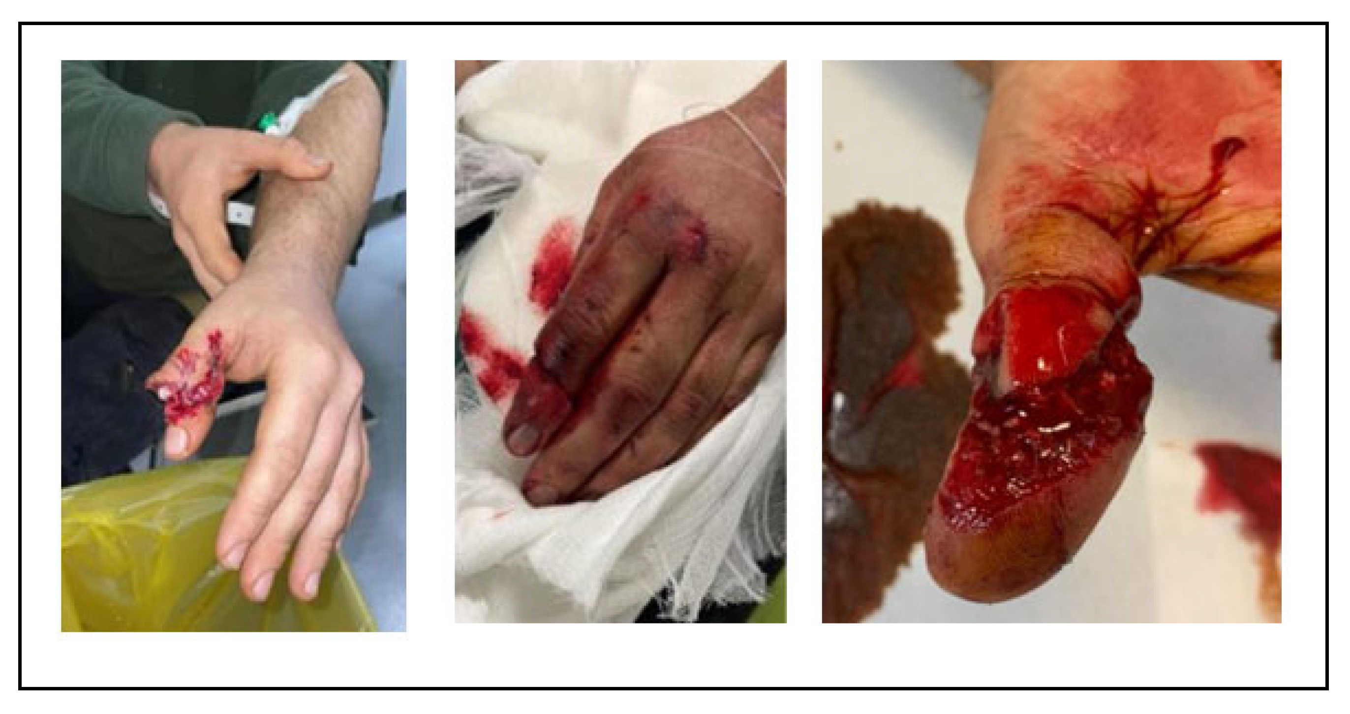 Surgeries 06 00103 g001