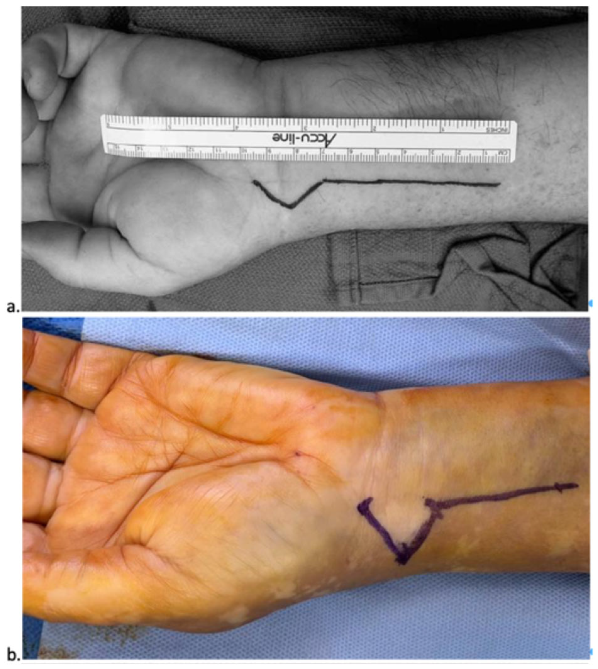 Surgeries 06 00104 g001