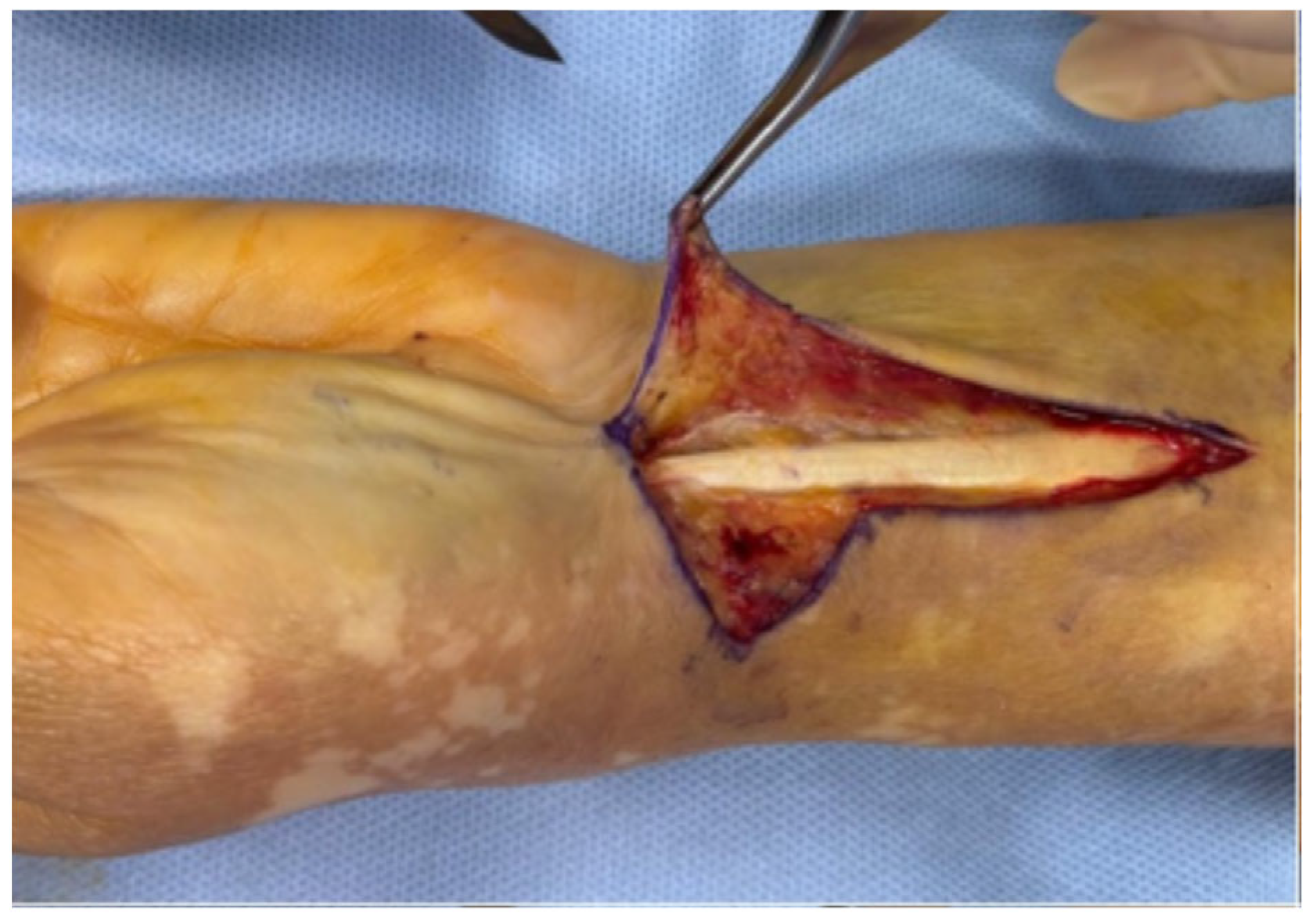 Surgeries 06 00104 g002