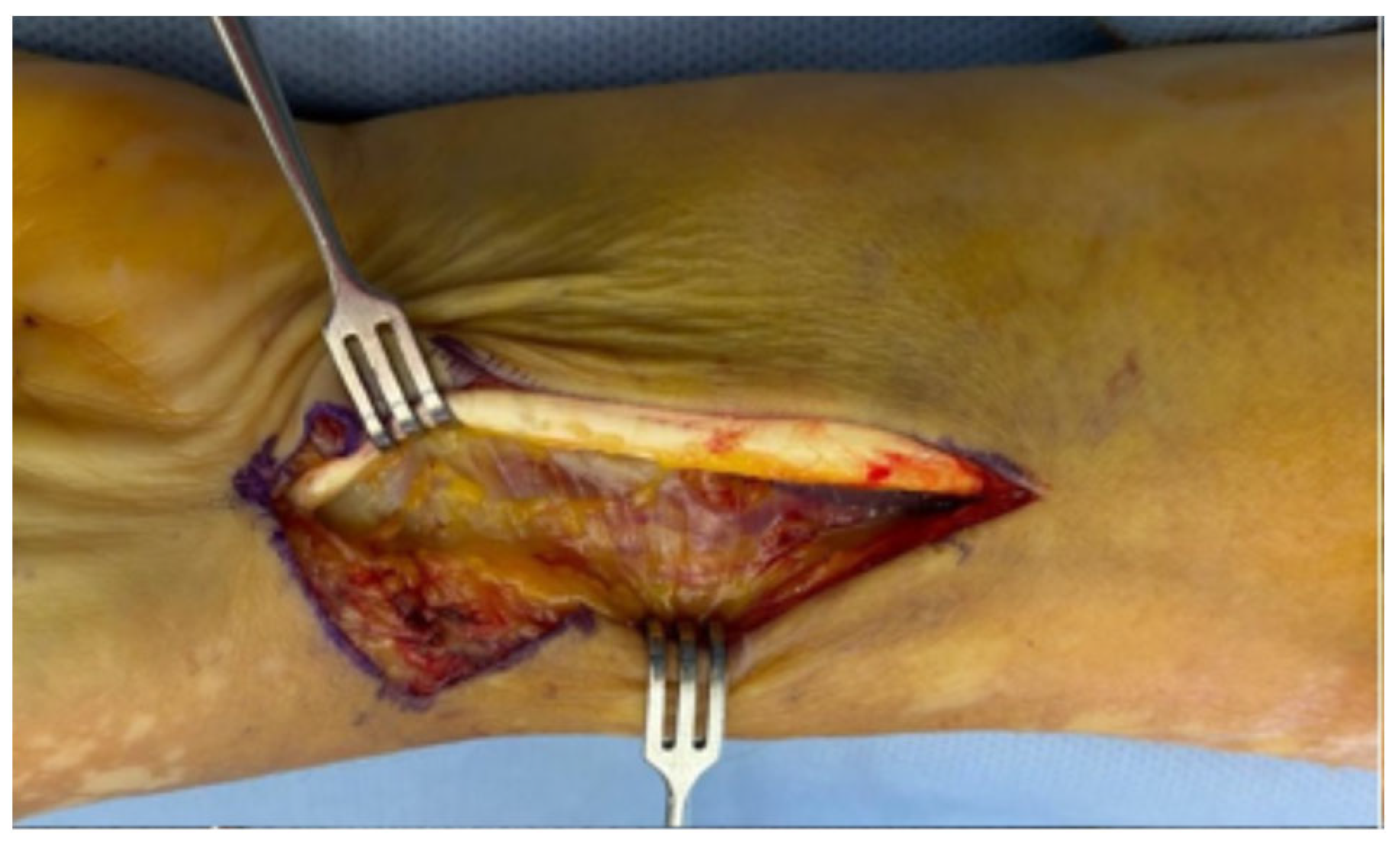 Surgeries 06 00104 g003