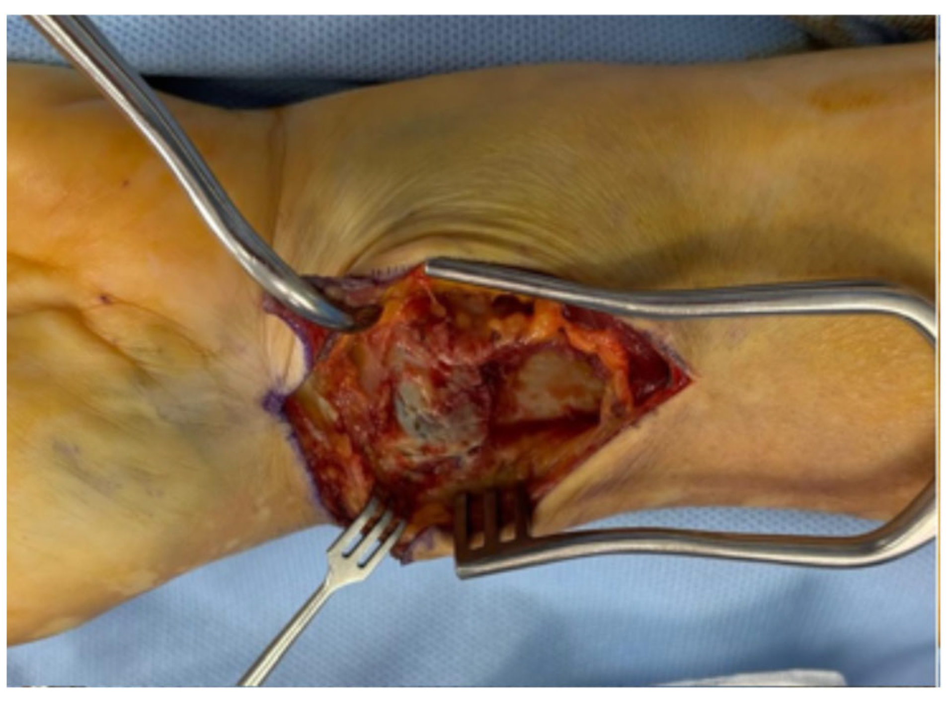 Surgeries 06 00104 g005