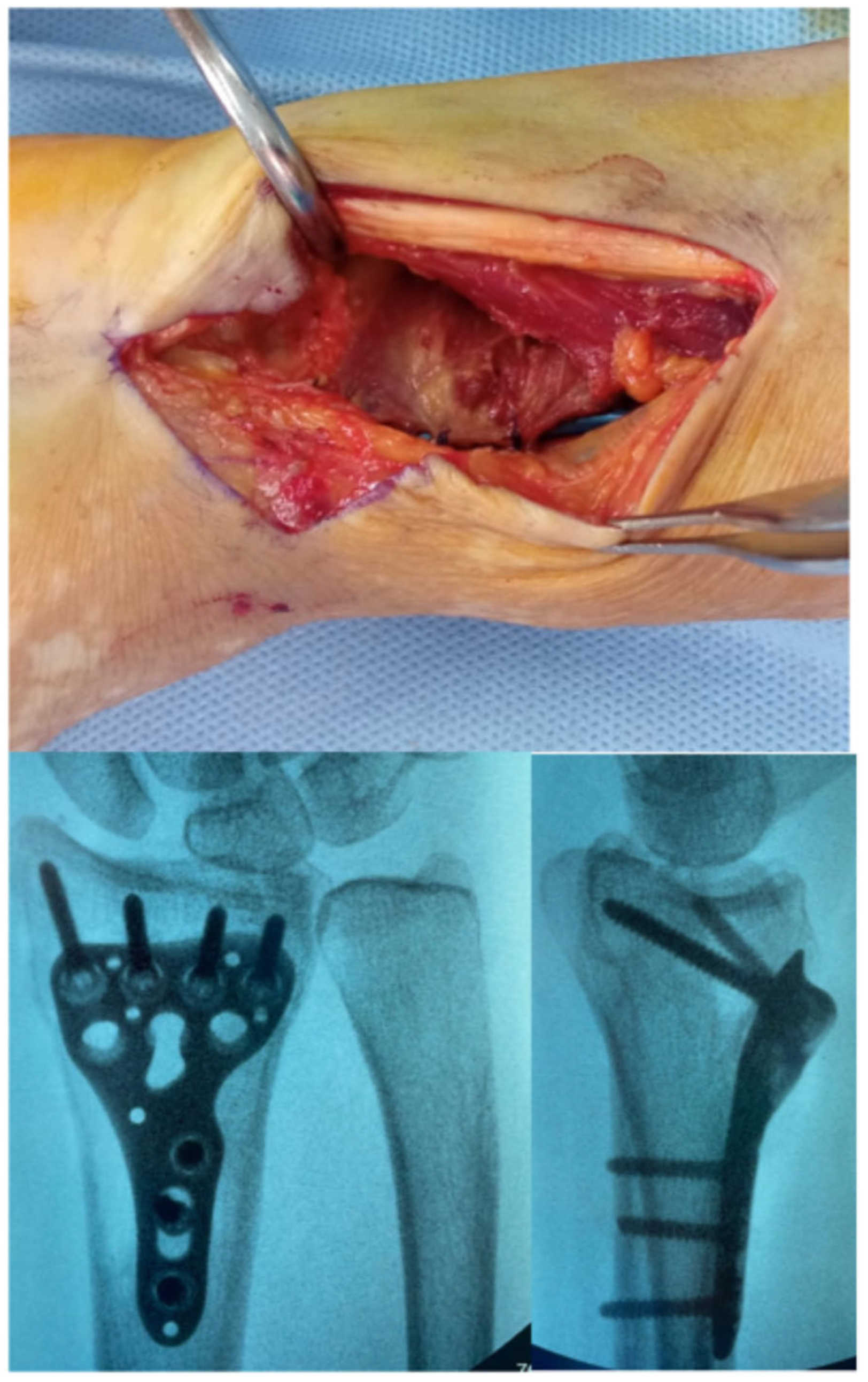 Surgeries 06 00104 g006