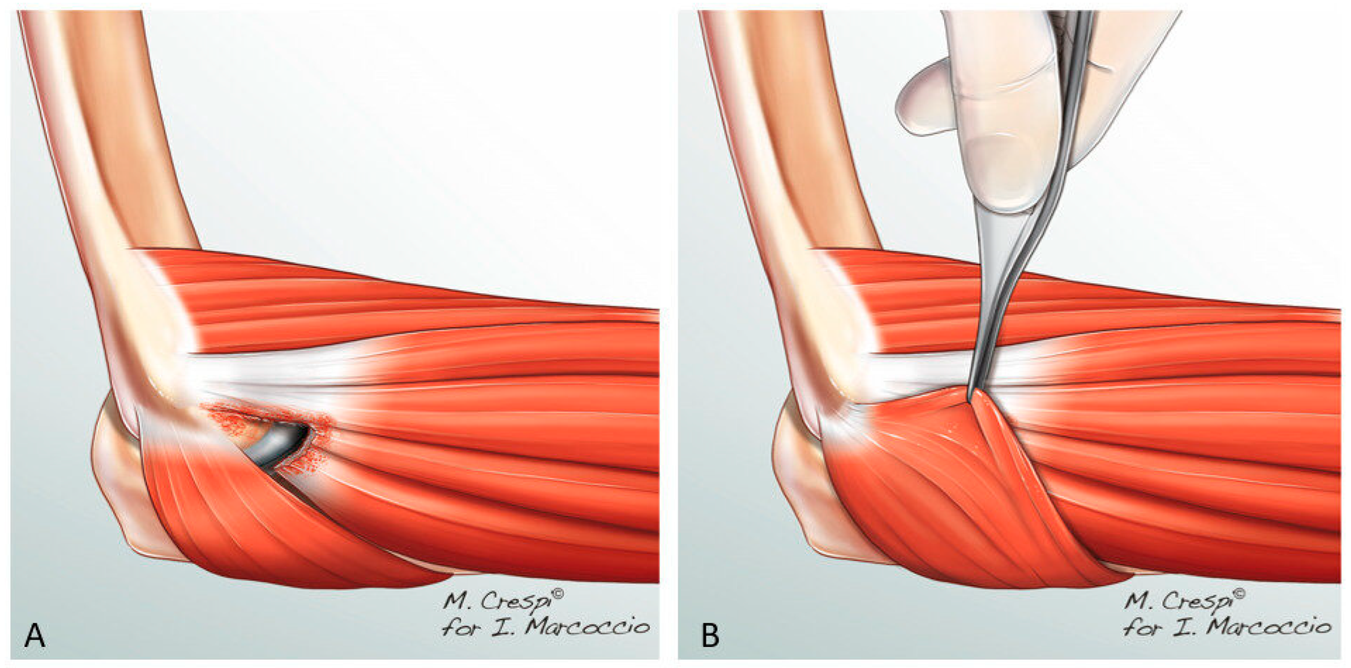 Surgeries 06 00105 g001