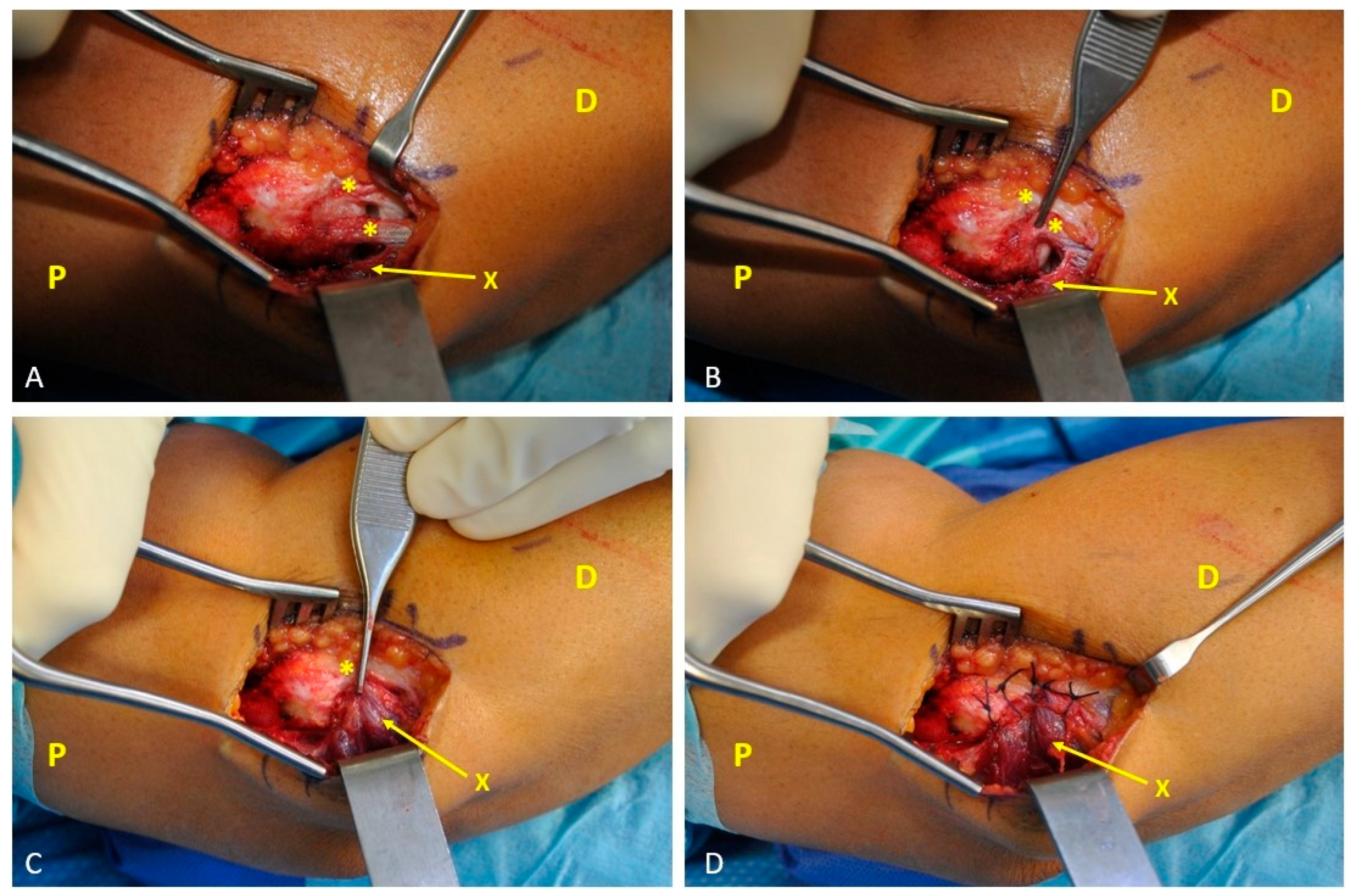 Surgeries 06 00105 g002