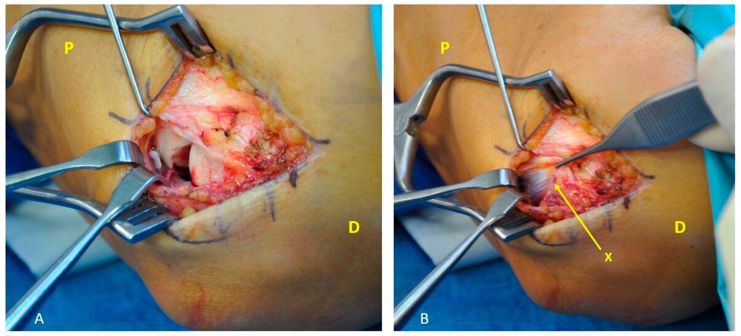 Surgeries 06 00105 g003