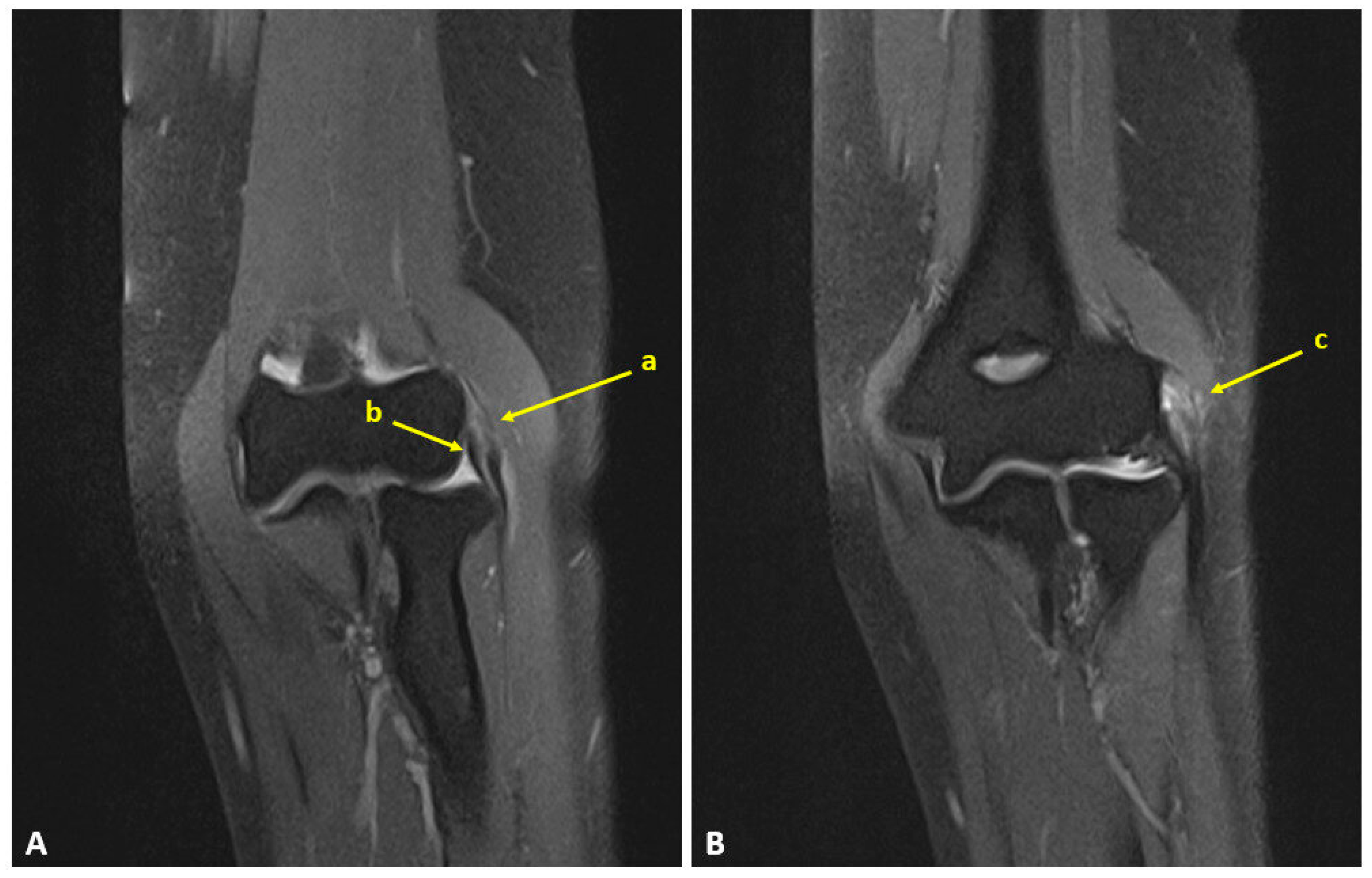 Surgeries 06 00105 g007