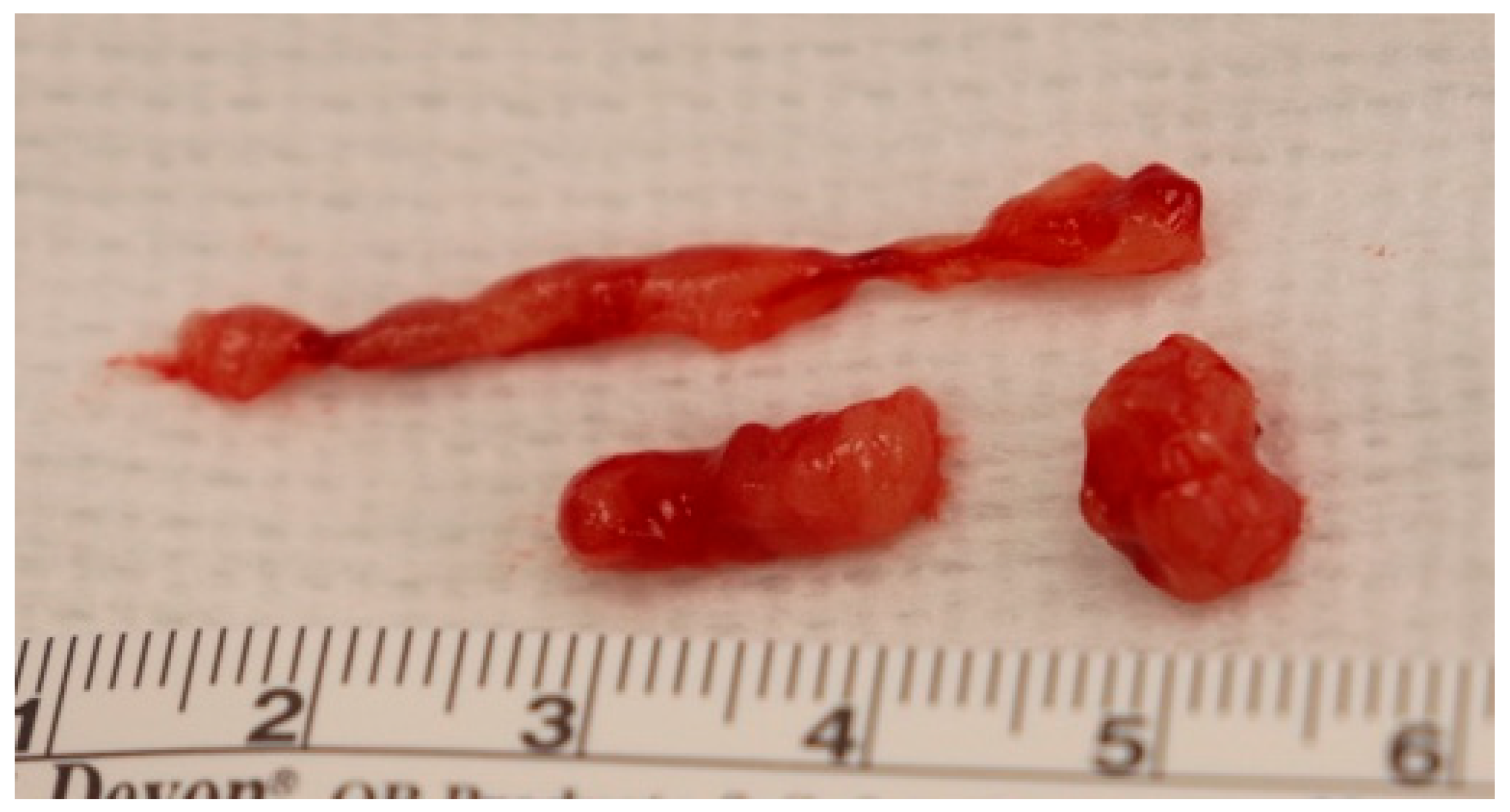 Surgeries 06 00106 g003