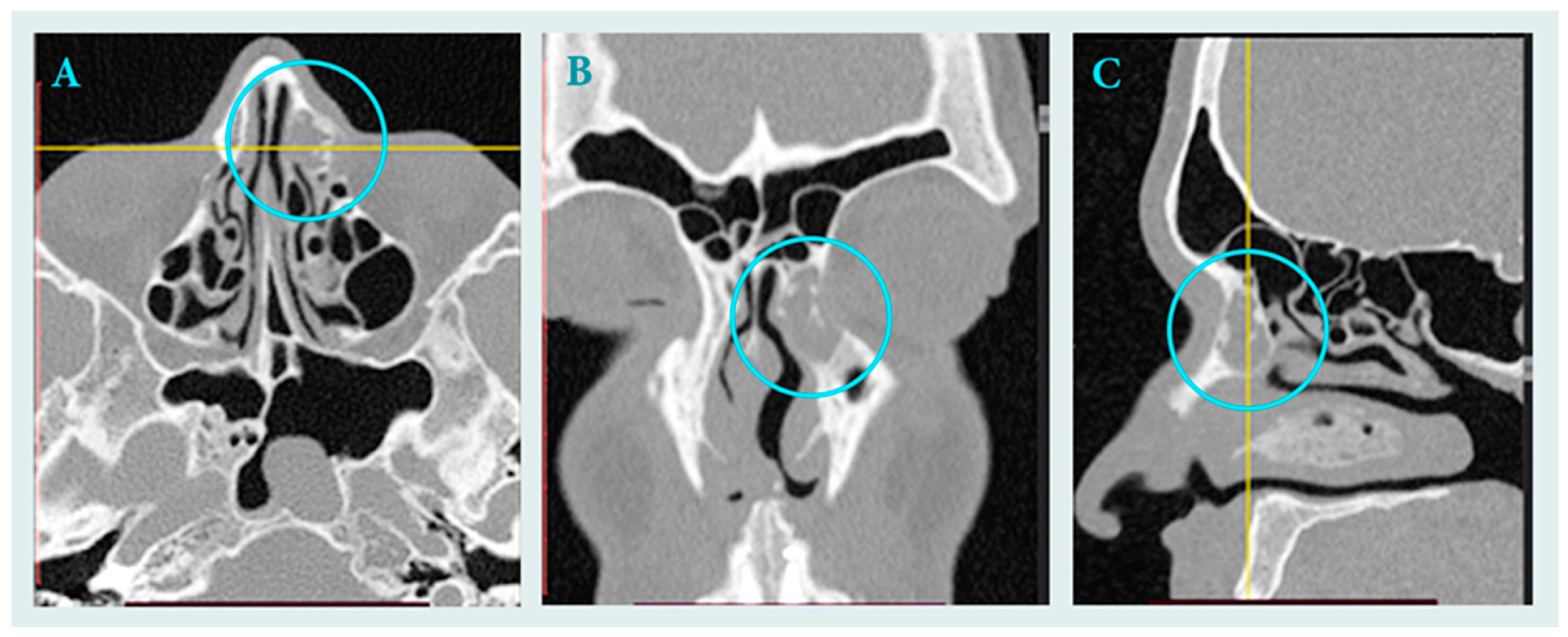 Surgeries 06 00107 g001 Surgeries 06 00107 g001