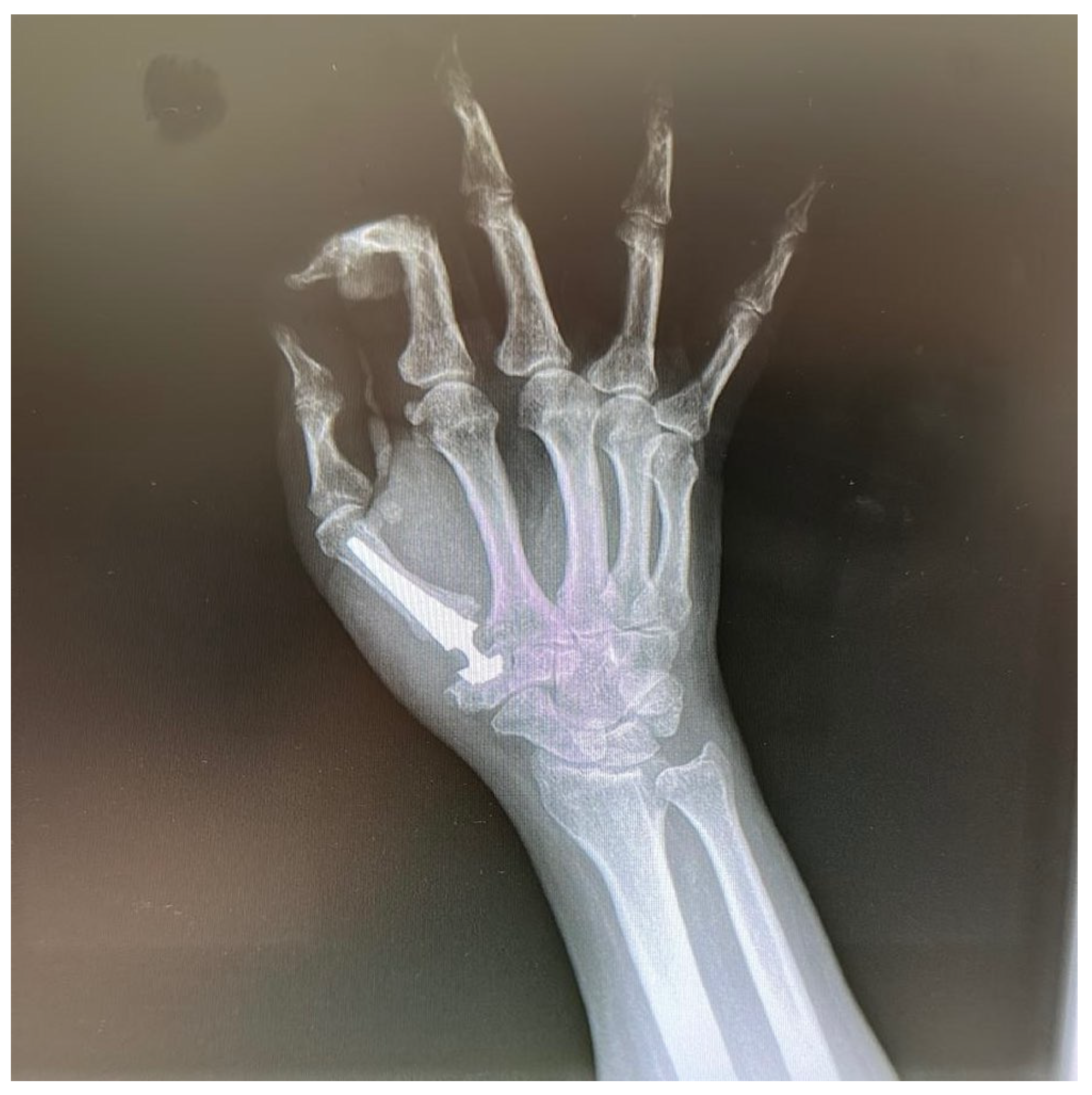 Surgeries 07 00006 g009