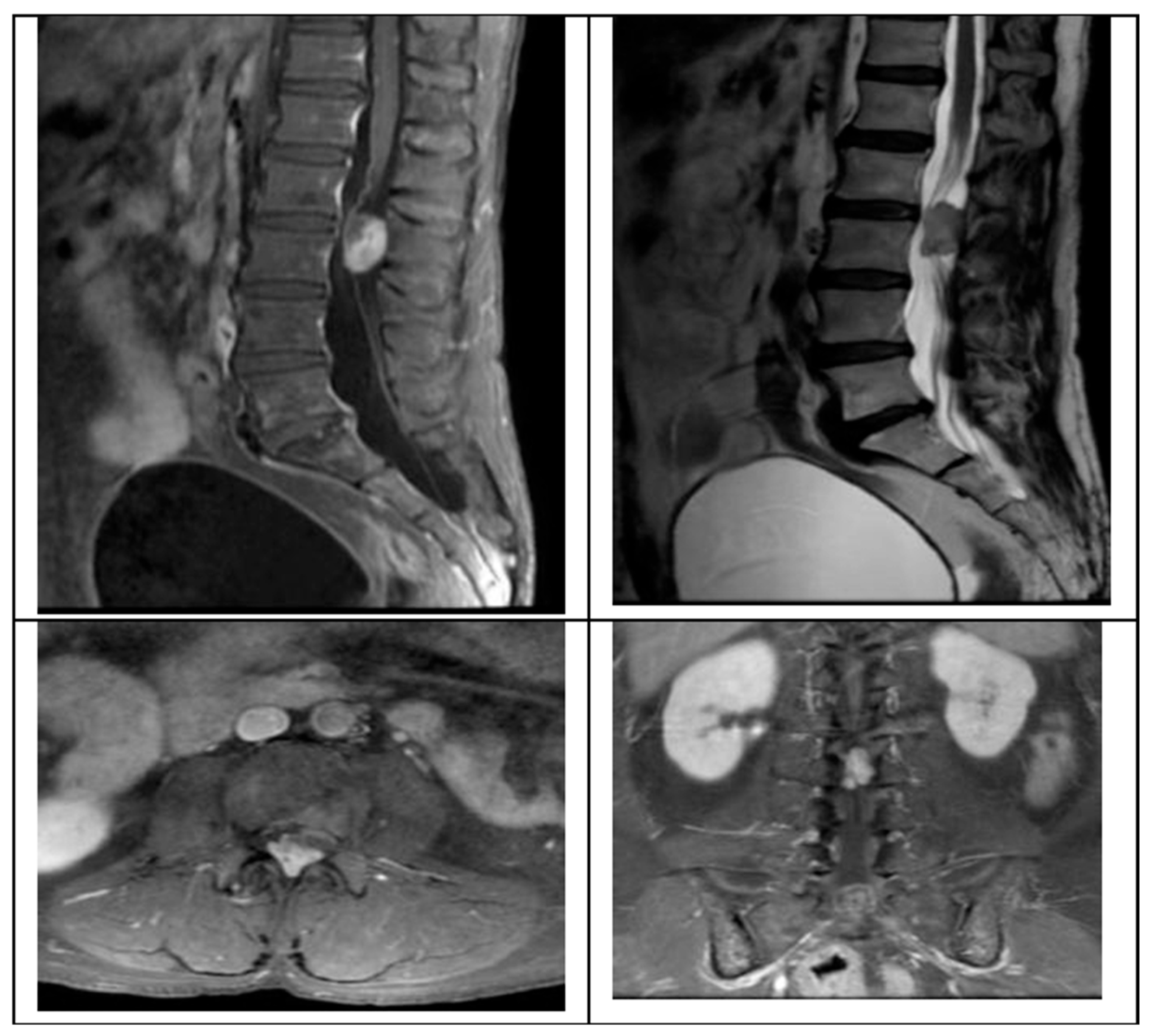 Surgeries 07 00014 g001