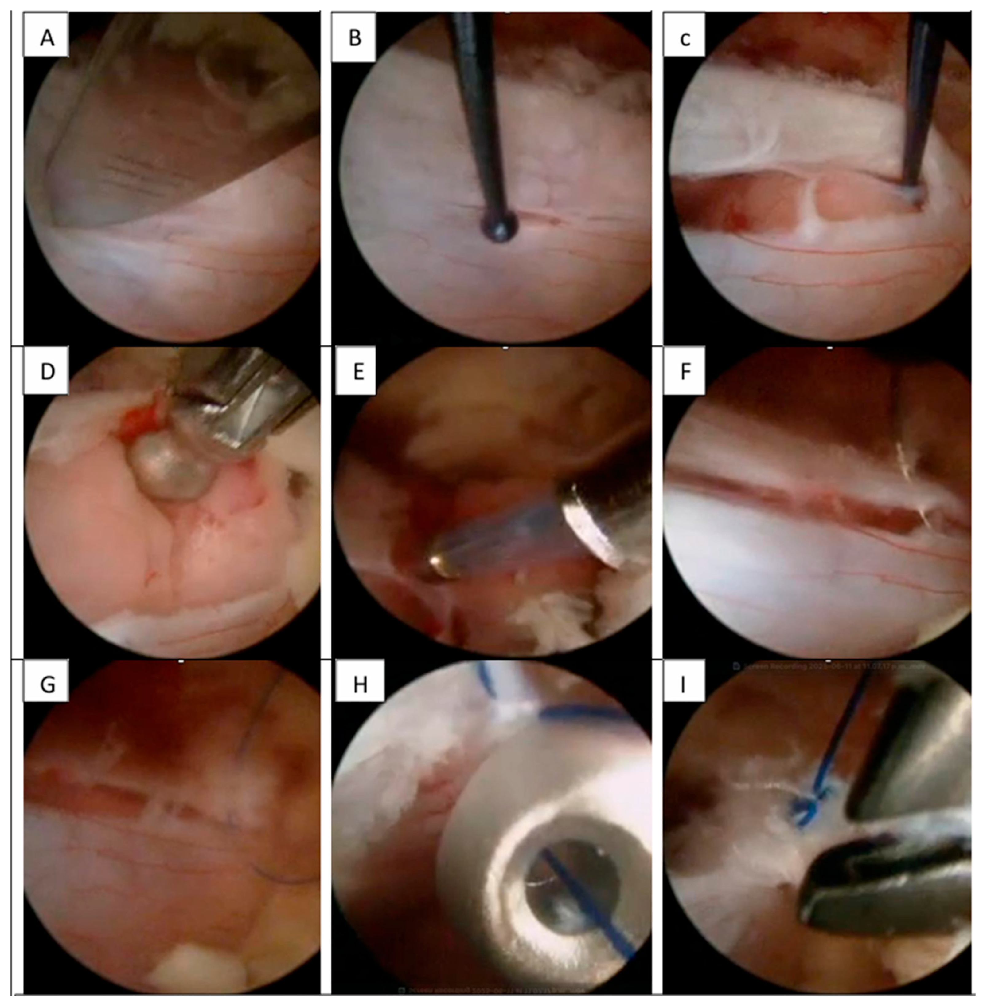 Surgeries 07 00014 g003