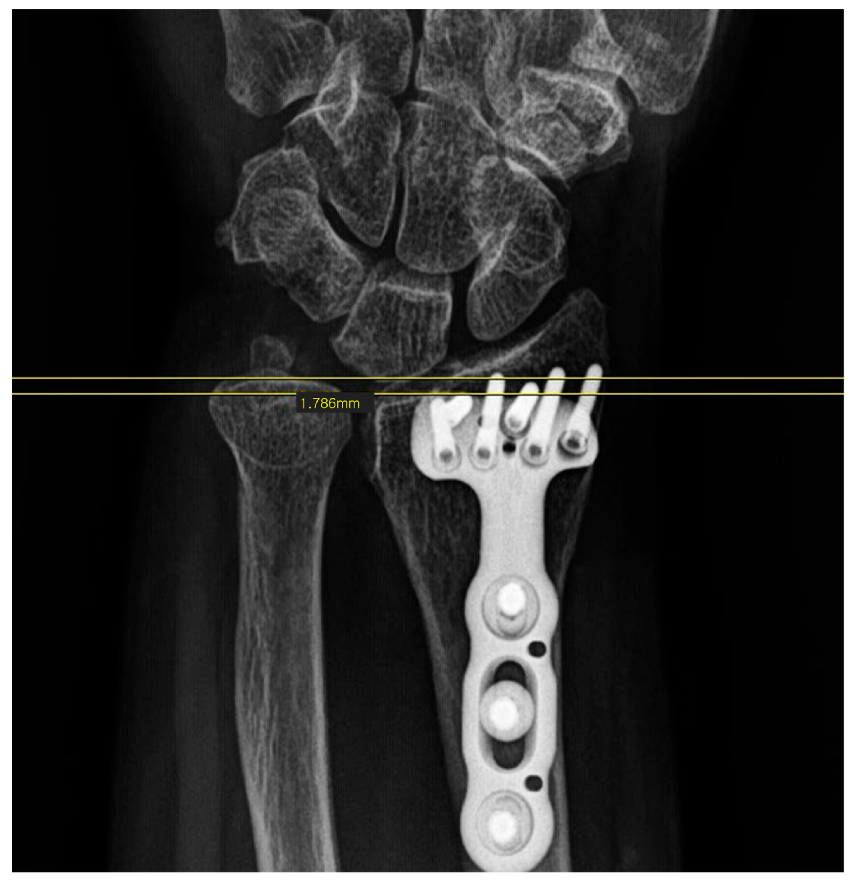 Surgeries 07 00039 g001