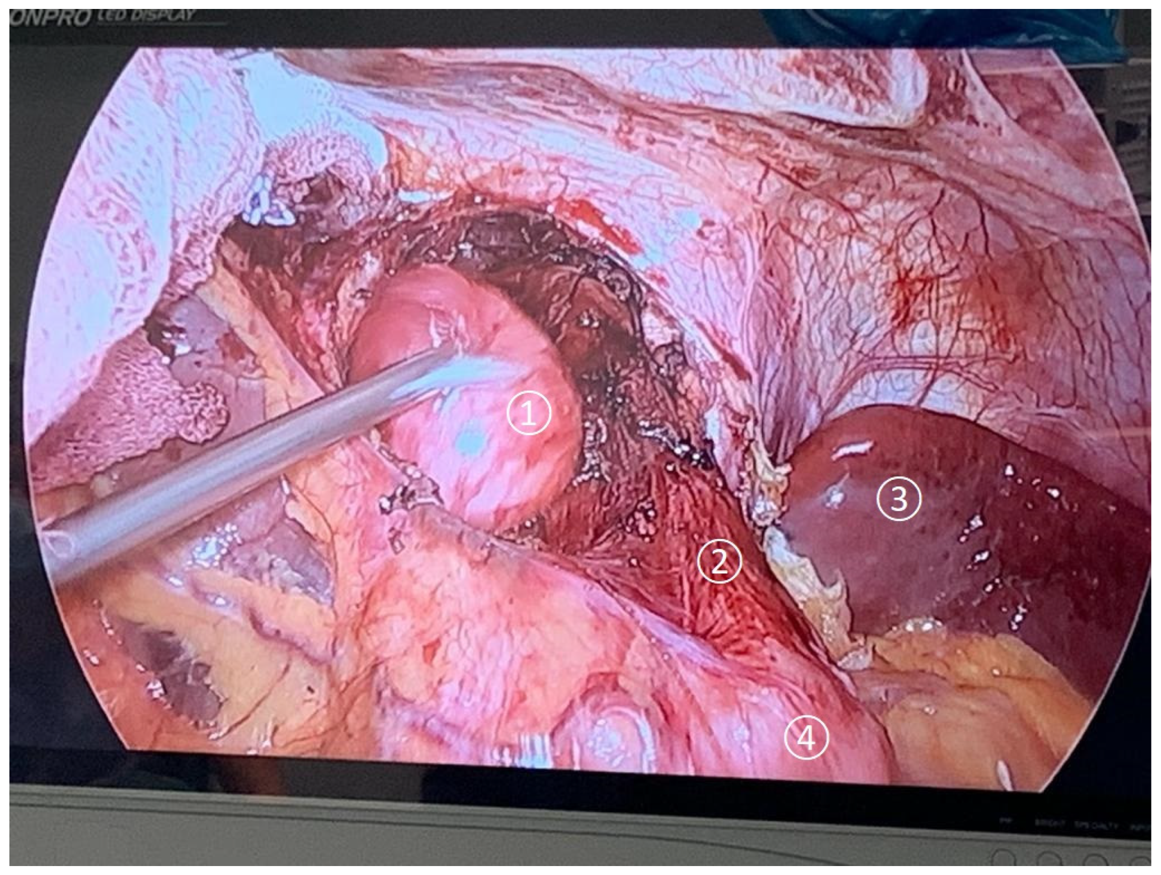 Surgeries 07 00054 g003