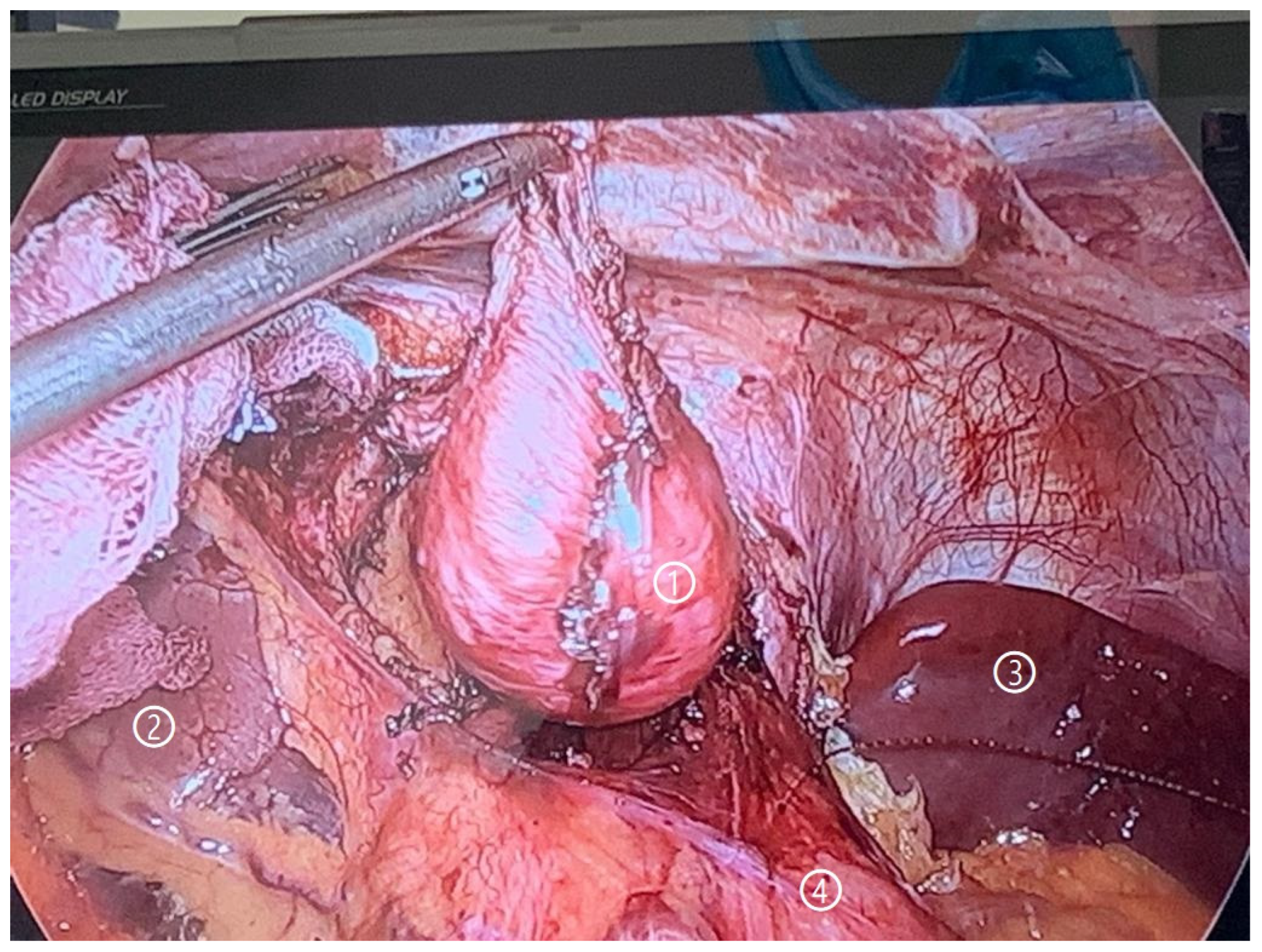 Surgeries 07 00054 g004