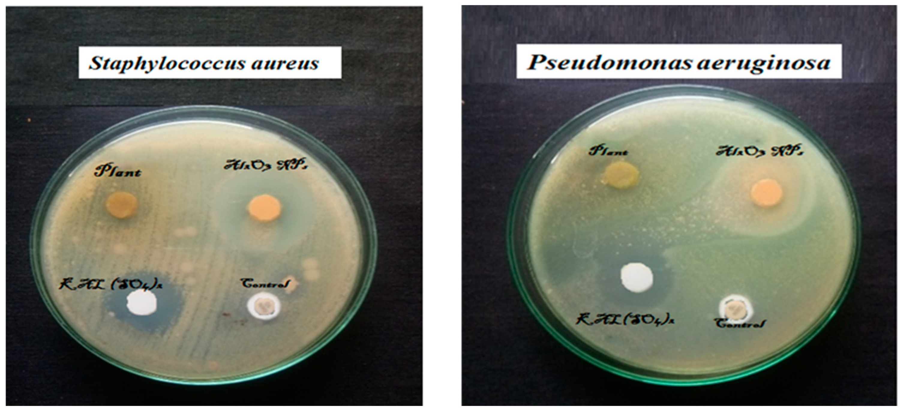 Sustainability 15 01743 g006 Sustainability 15 01743 g006