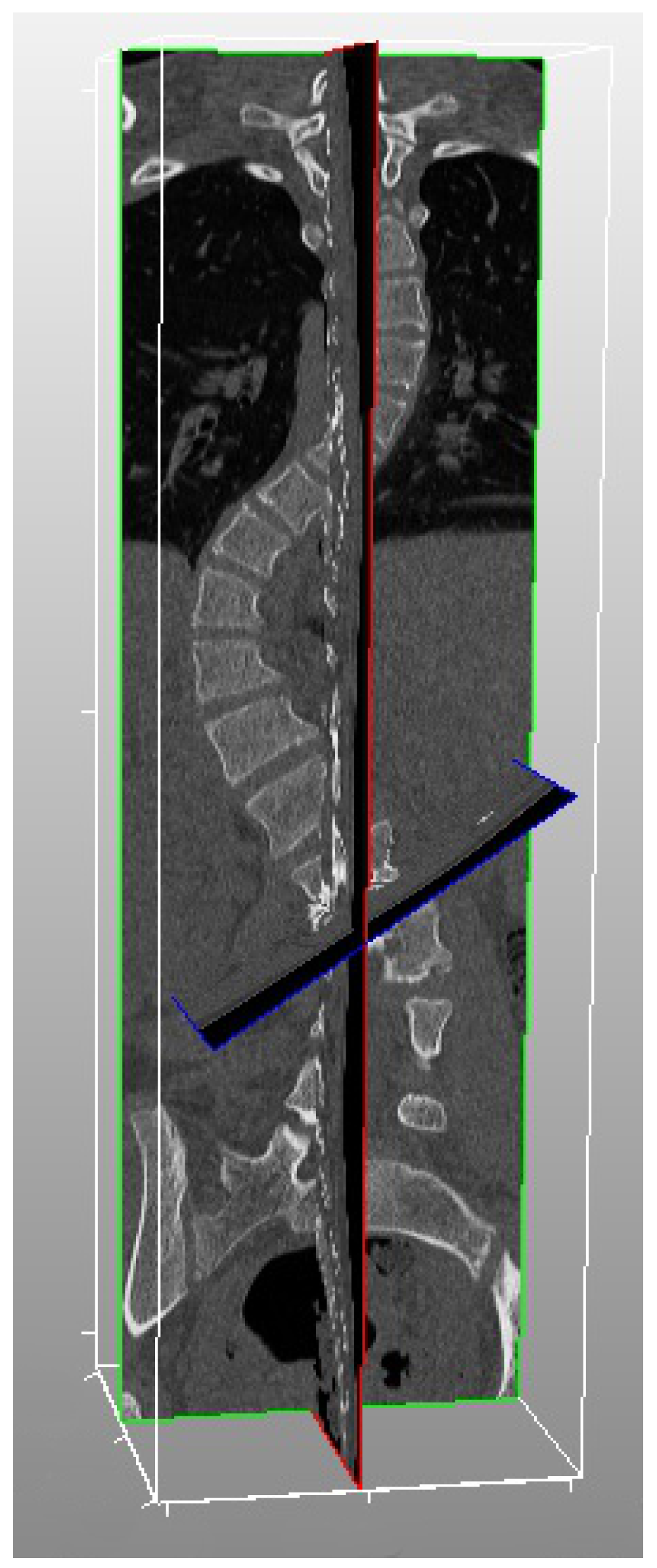Symmetry 08 00125 g003