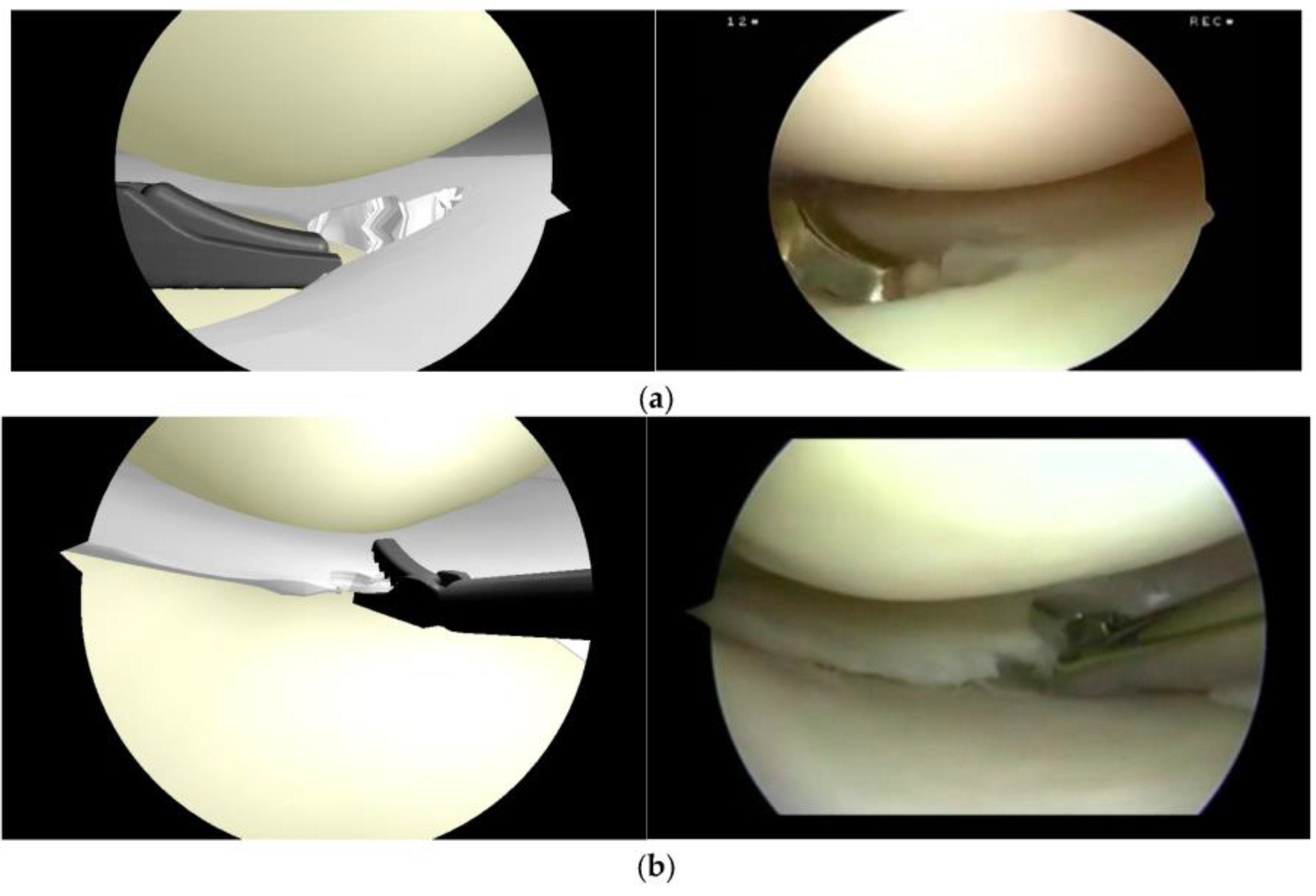 Symmetry 10 00017 g021 Symmetry 10 00017 g021