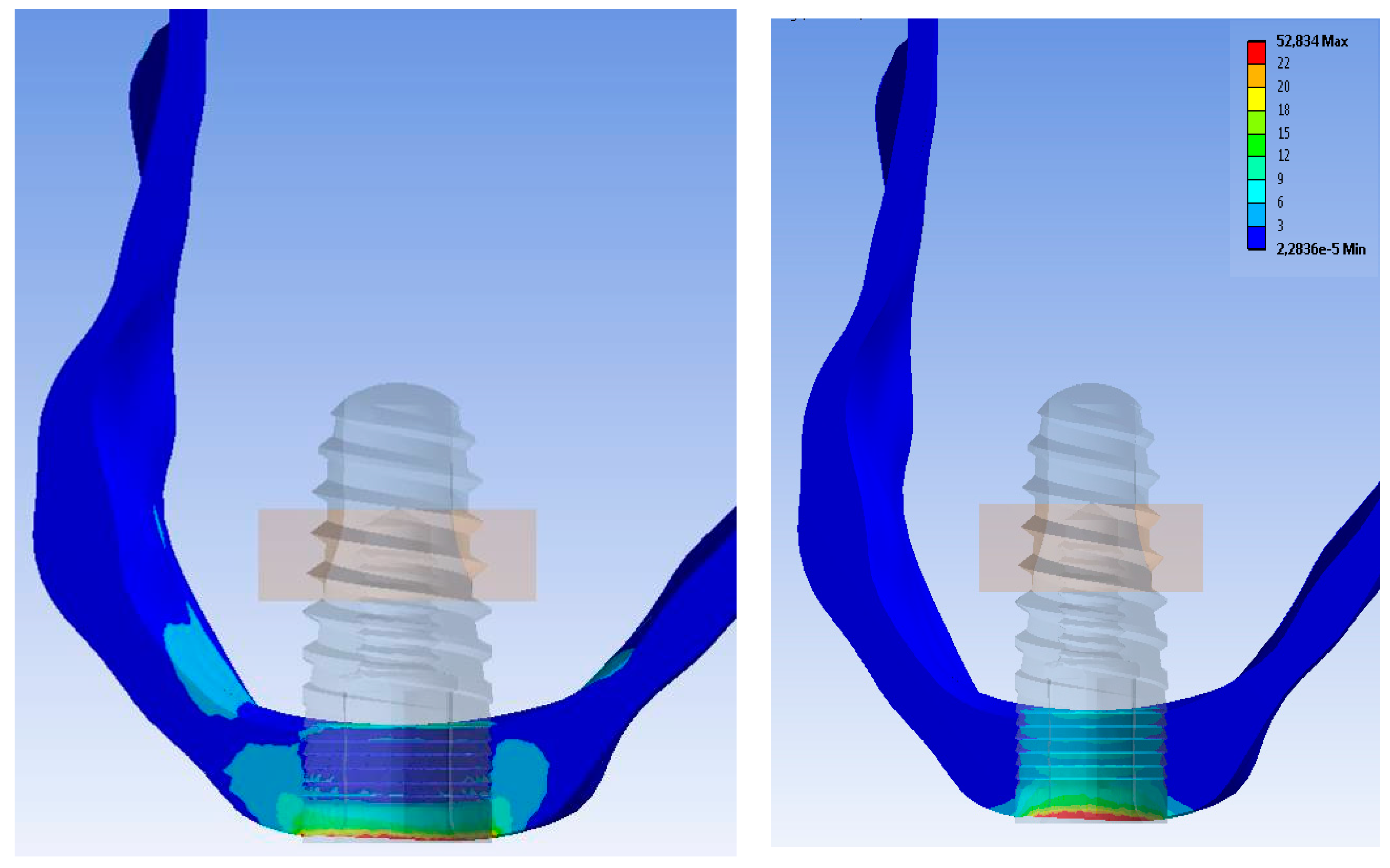 Symmetry 10 00033 g005 550
