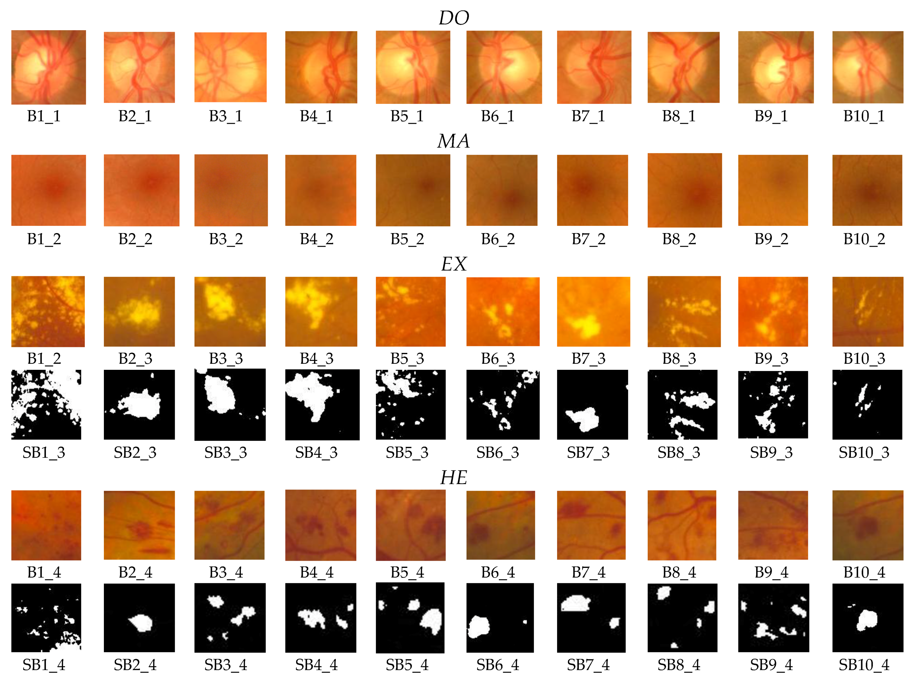 Symmetry 10 00073 g011