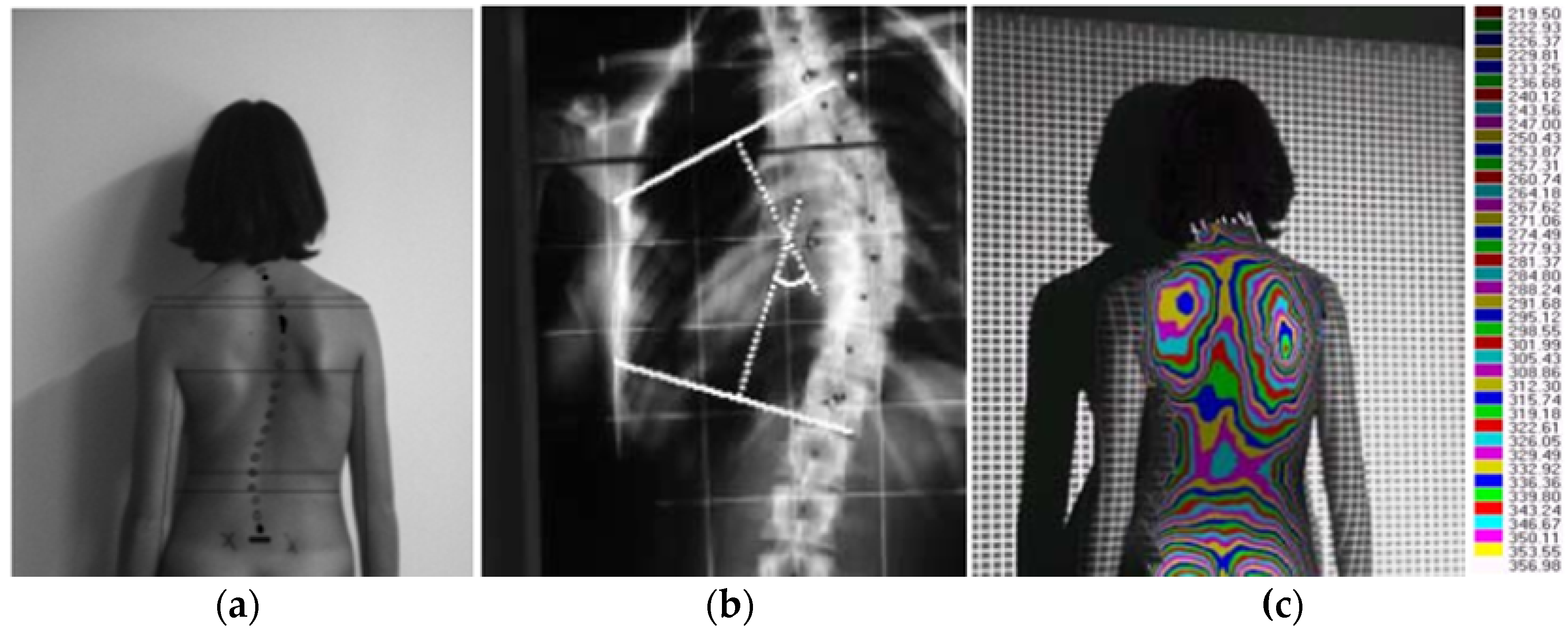 Symmetry 10 00263 g001 Symmetry 10 00263 g001