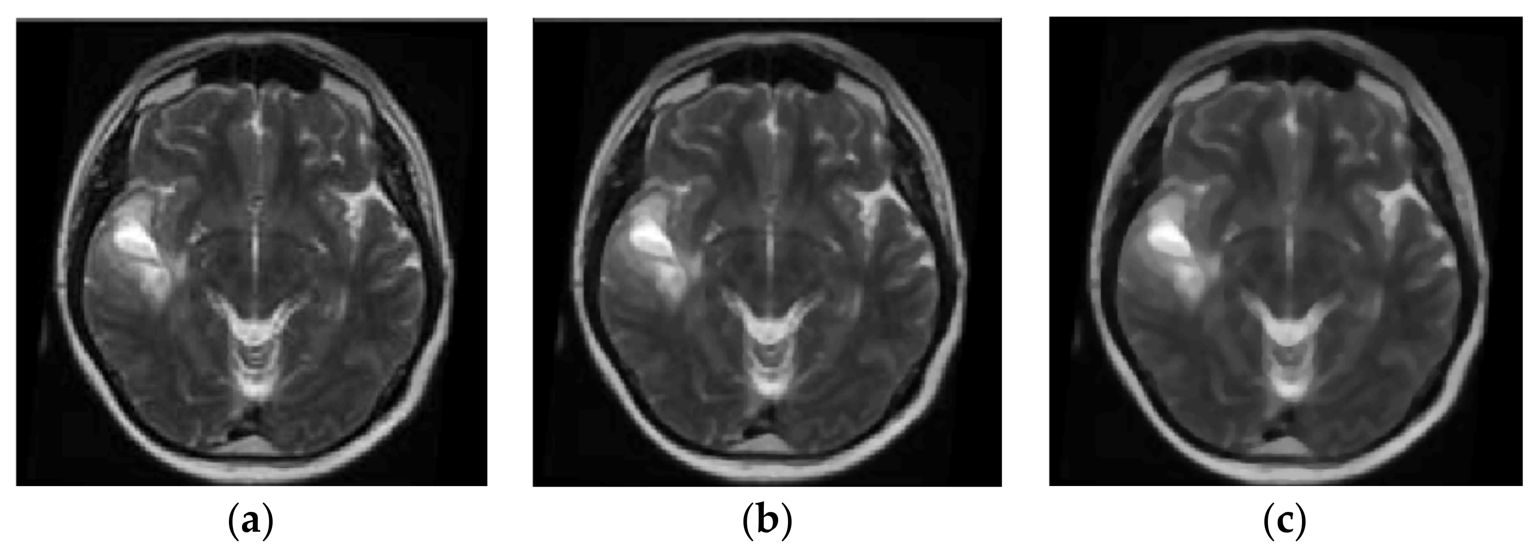 Symmetry 10 00270 g005