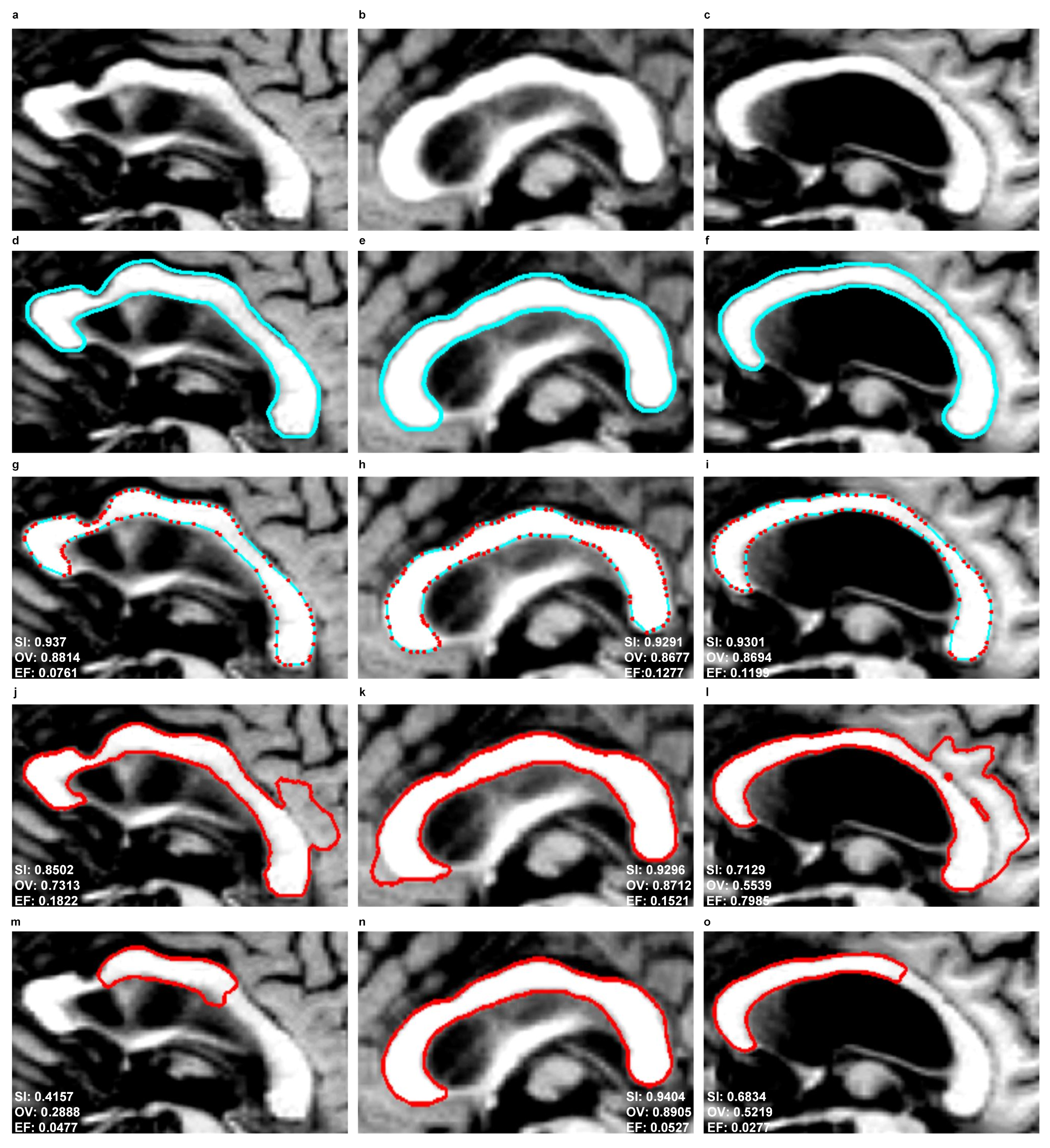 Symmetry 10 00589 g011