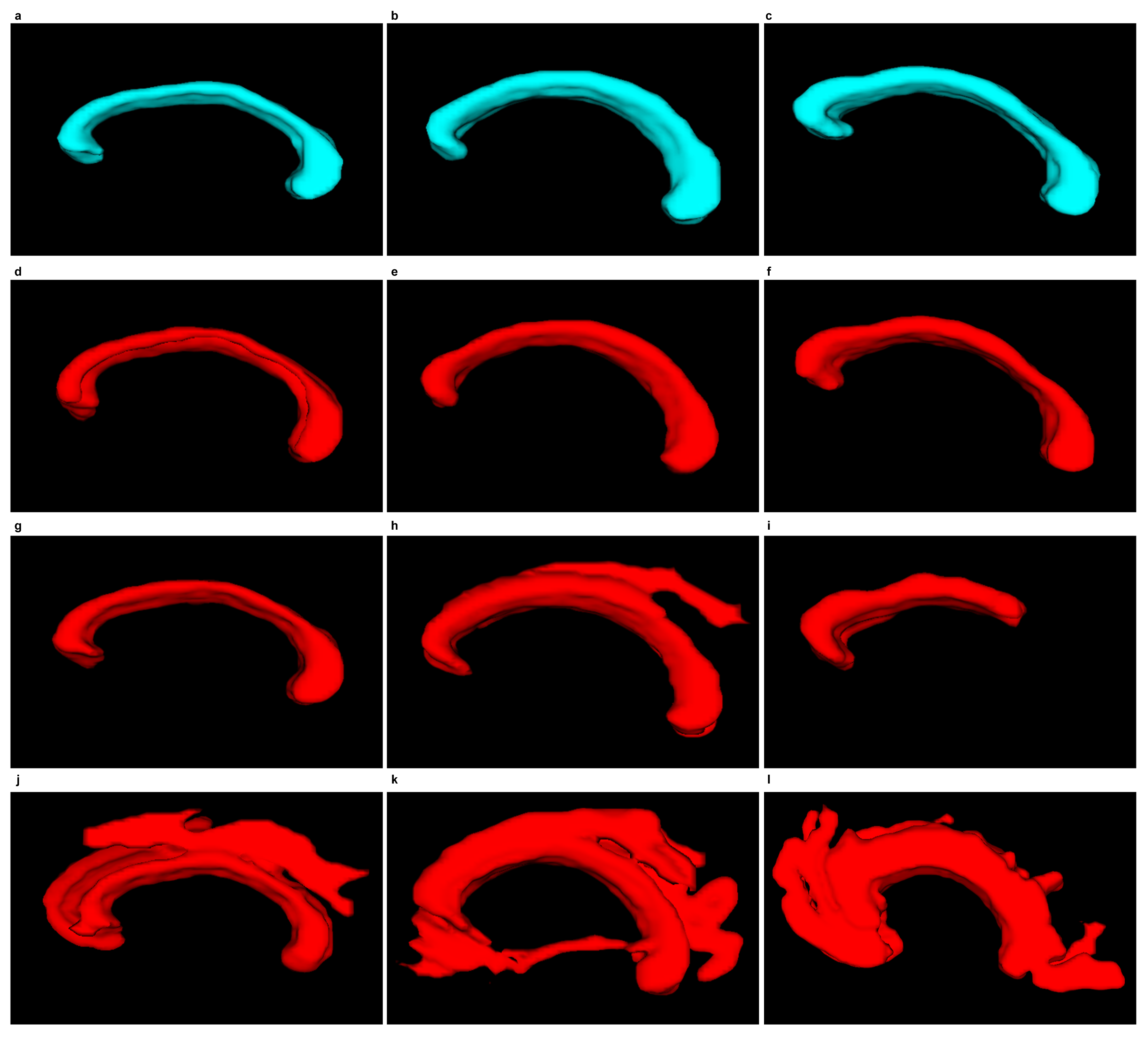 Symmetry 10 00589 g012