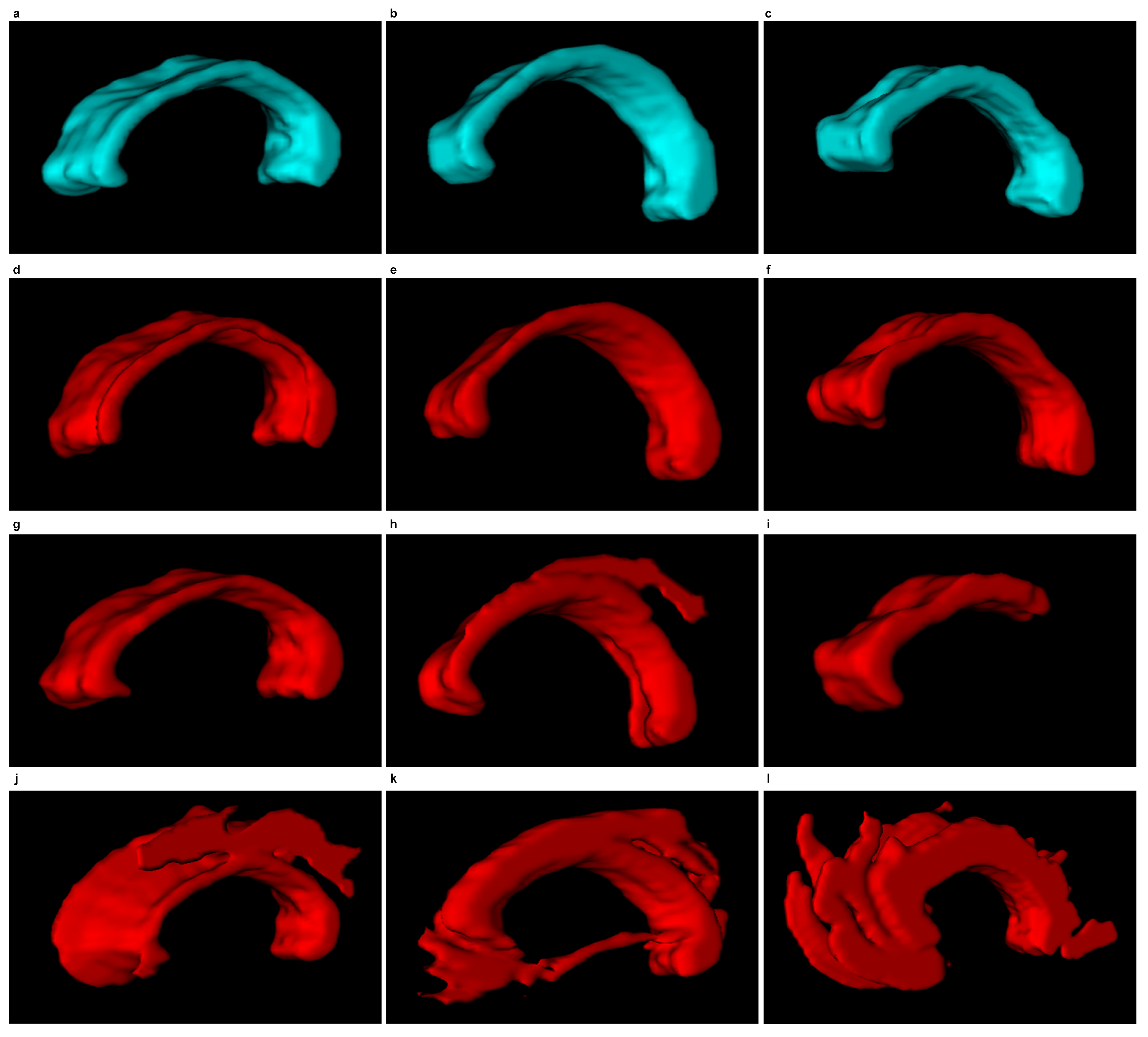 Symmetry 10 00589 g013
