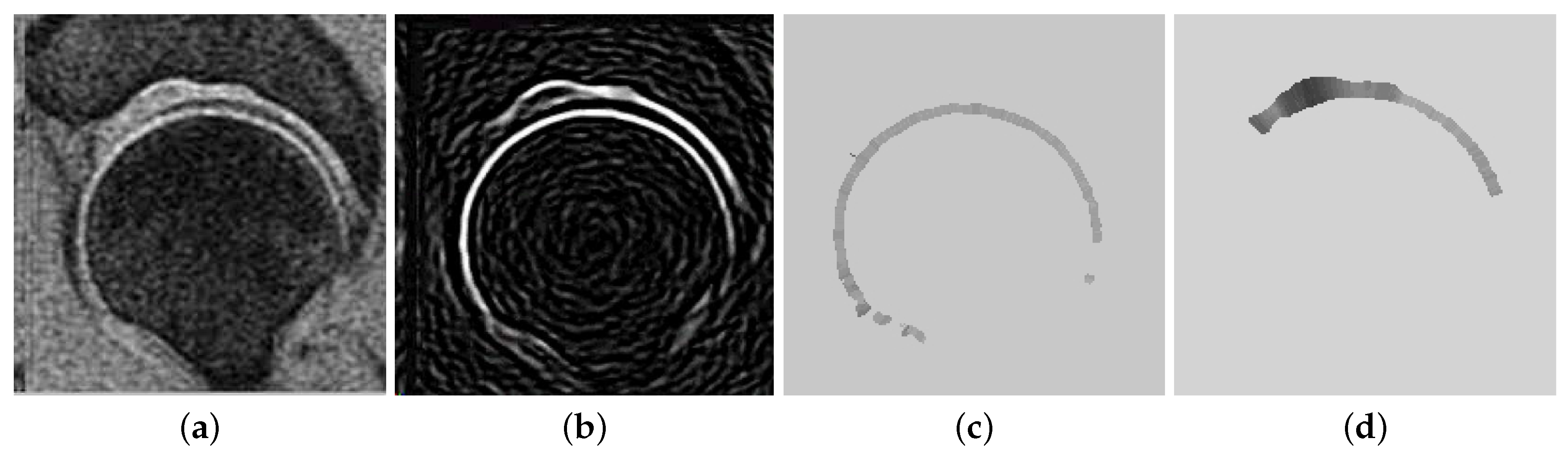 Symmetry 10 00591 g002 Symmetry 10 00591 g002