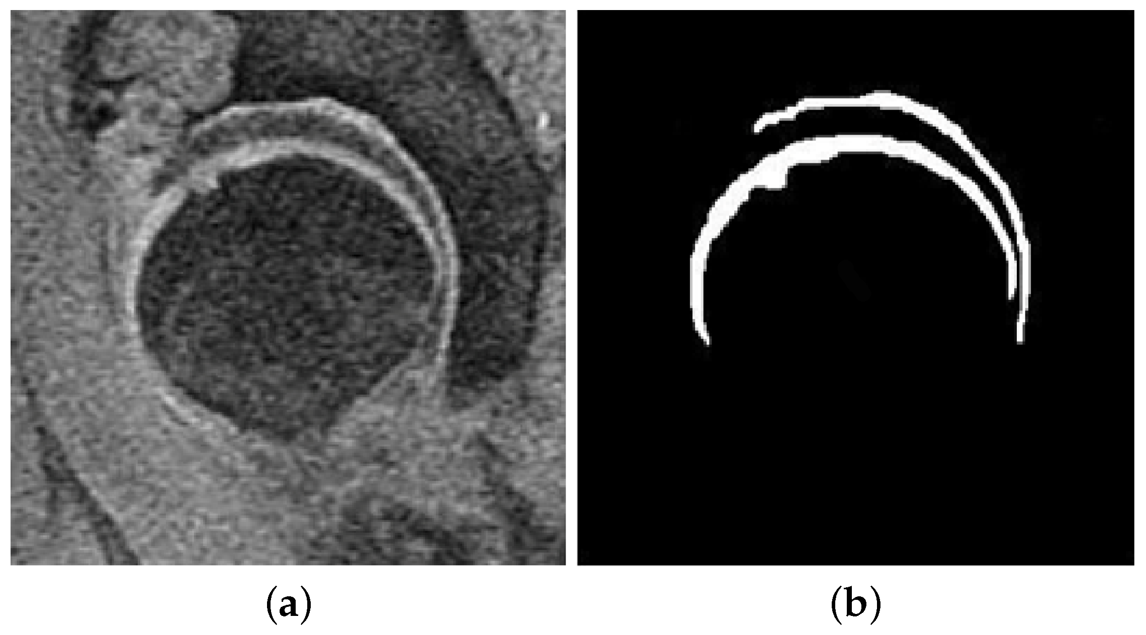 Symmetry 10 00591 g006 Symmetry 10 00591 g006