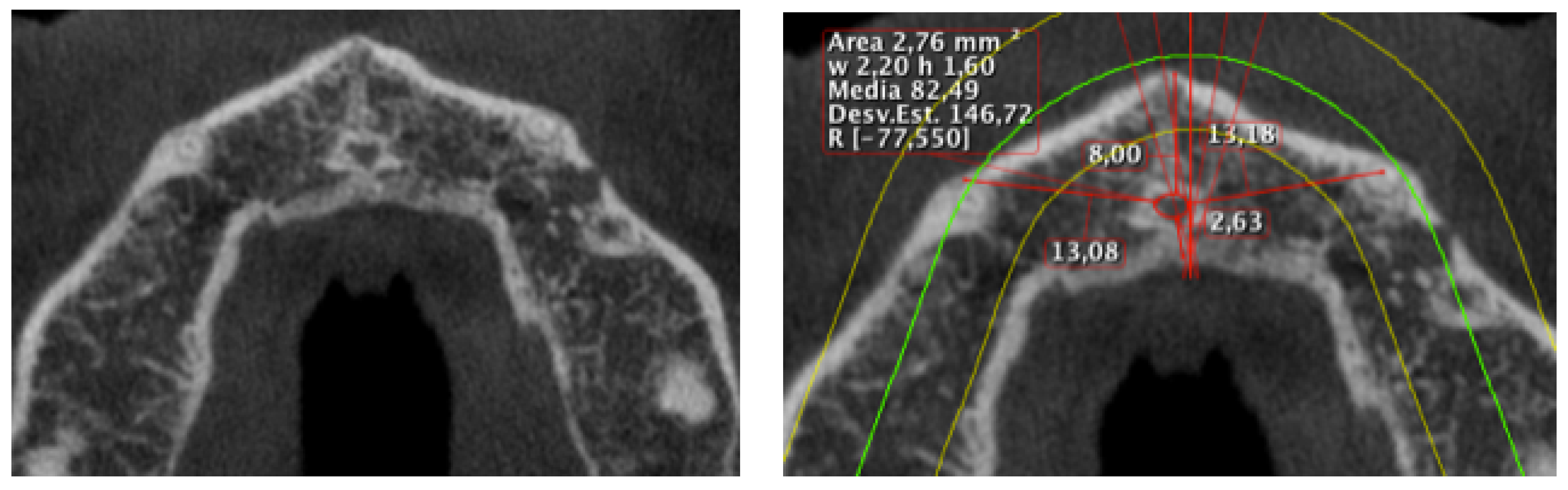 Symmetry 11 00202 g001