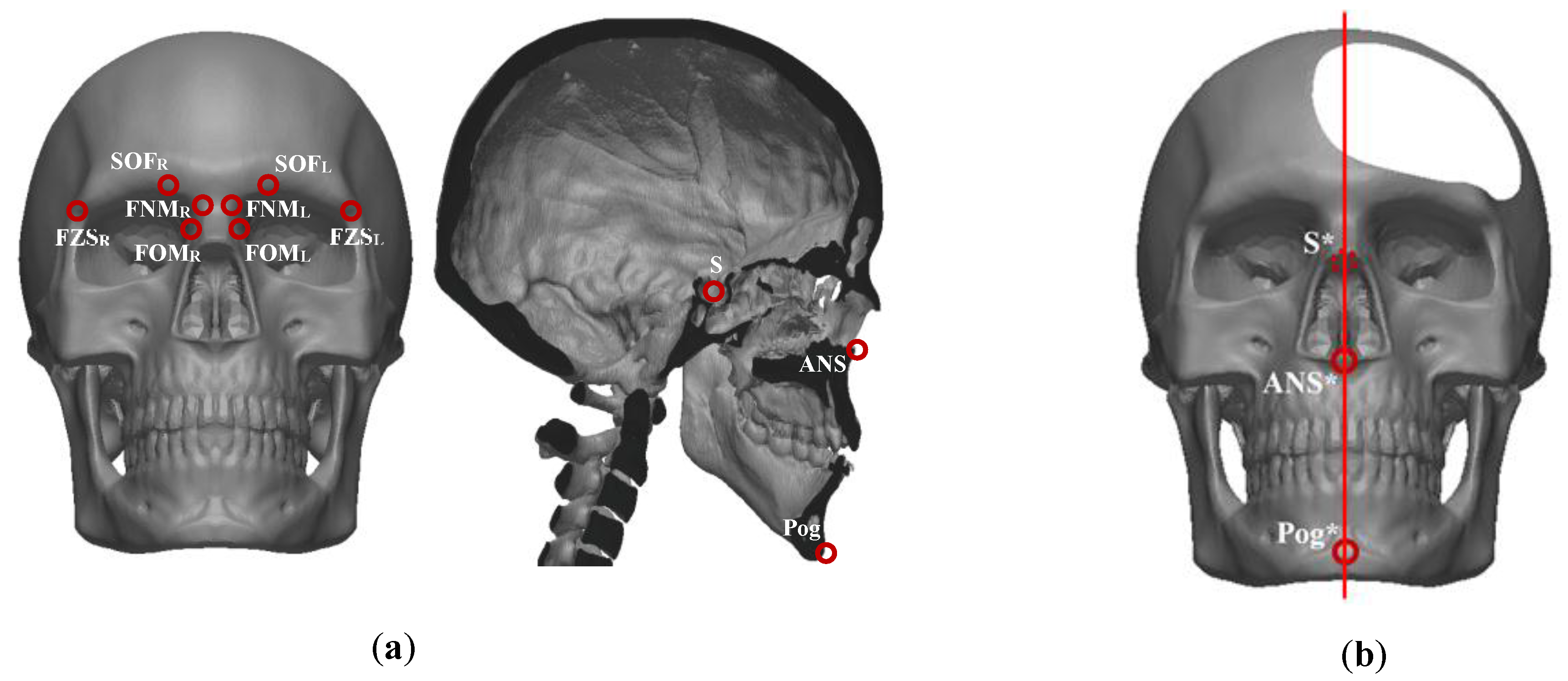 Symmetry 11 00245 g002 Symmetry 11 00245 g002