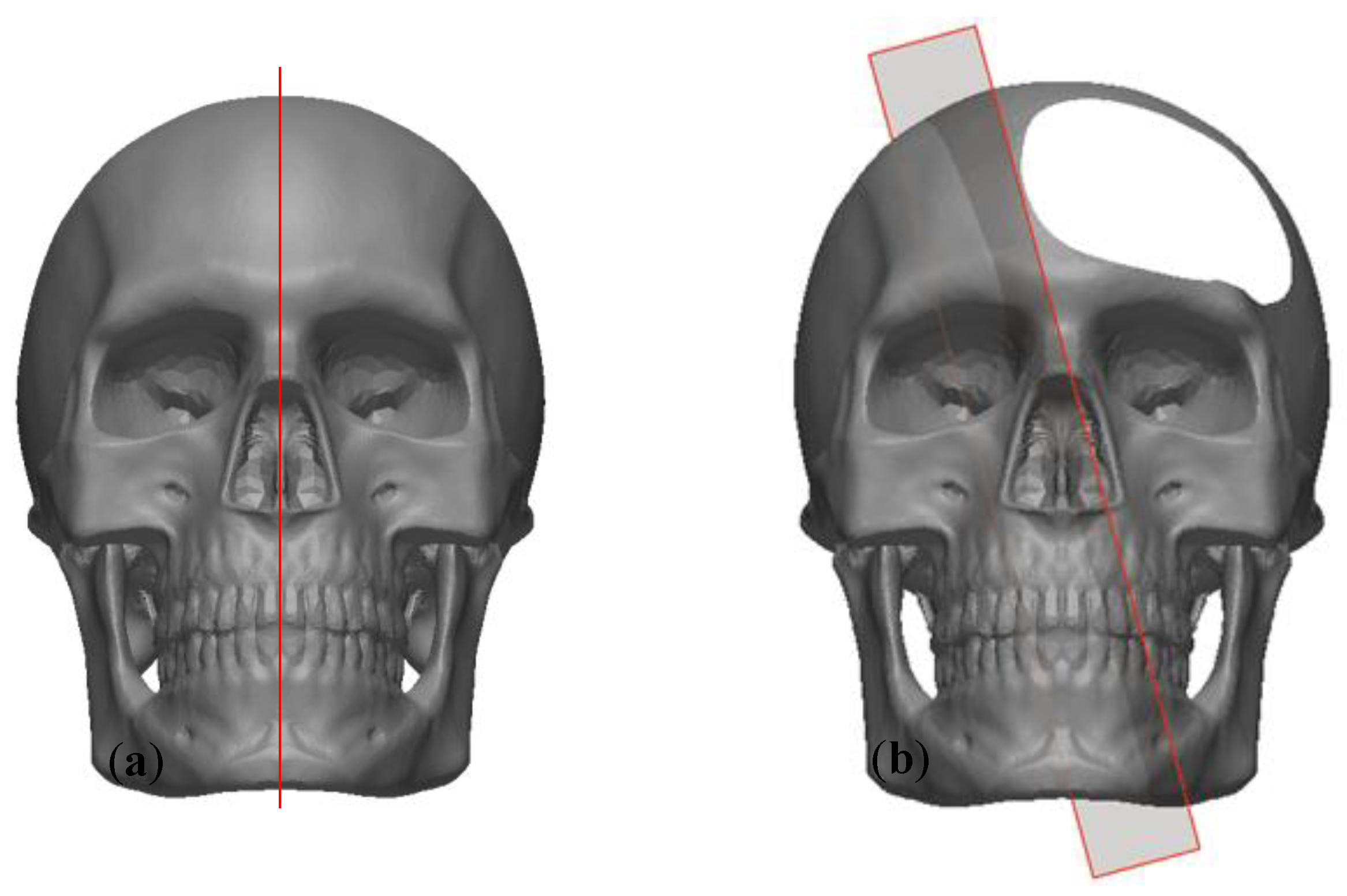 Symmetry 11 00245 g003 Symmetry 11 00245 g003