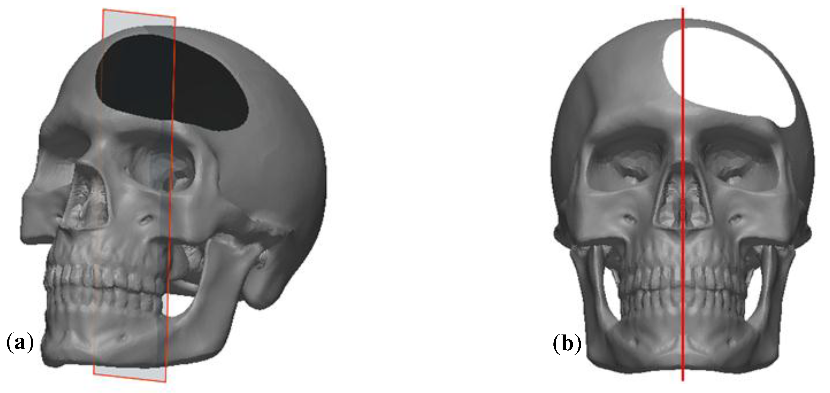 Symmetry 11 00245 g005 Symmetry 11 00245 g005