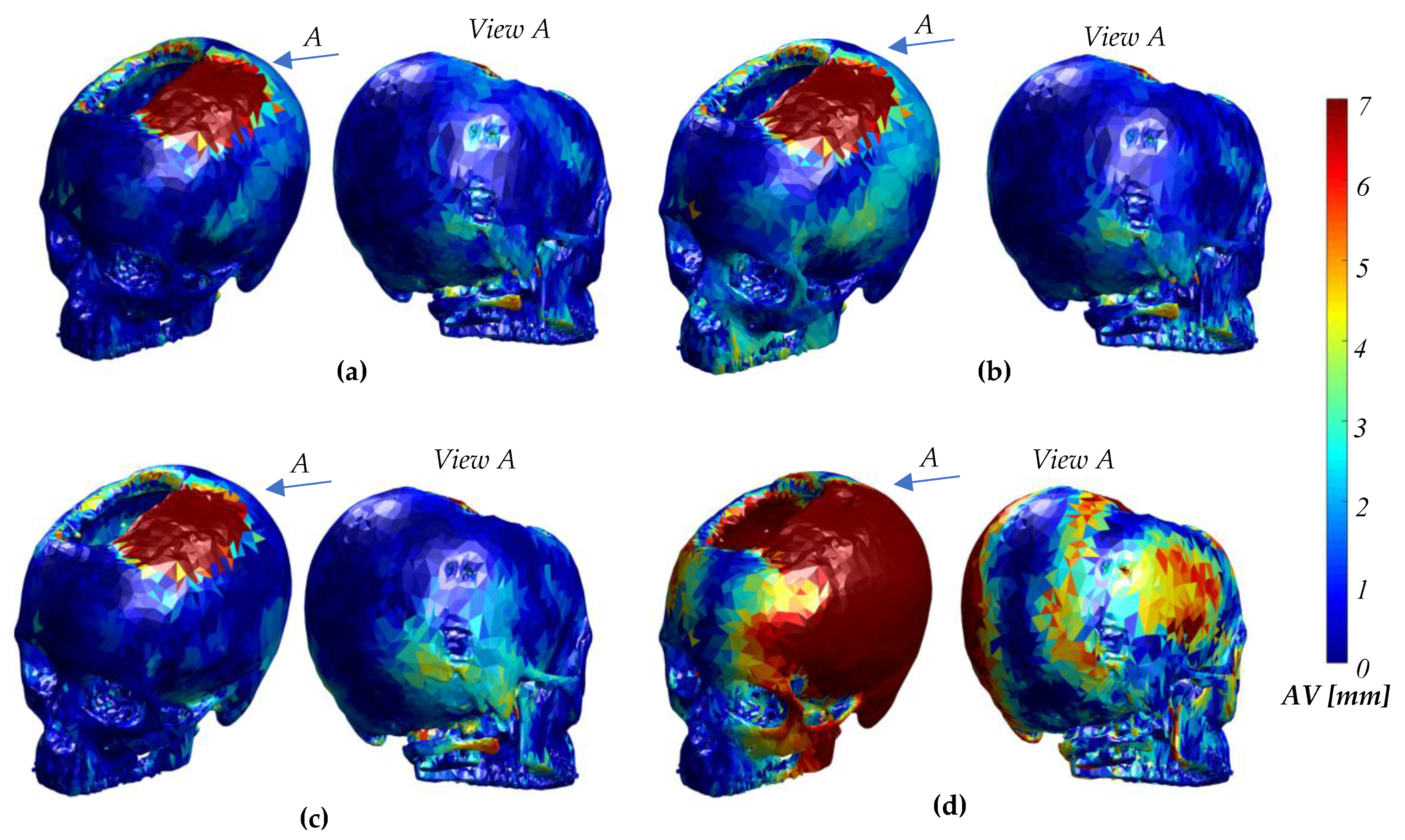 Symmetry 11 00245 g007 Symmetry 11 00245 g007
