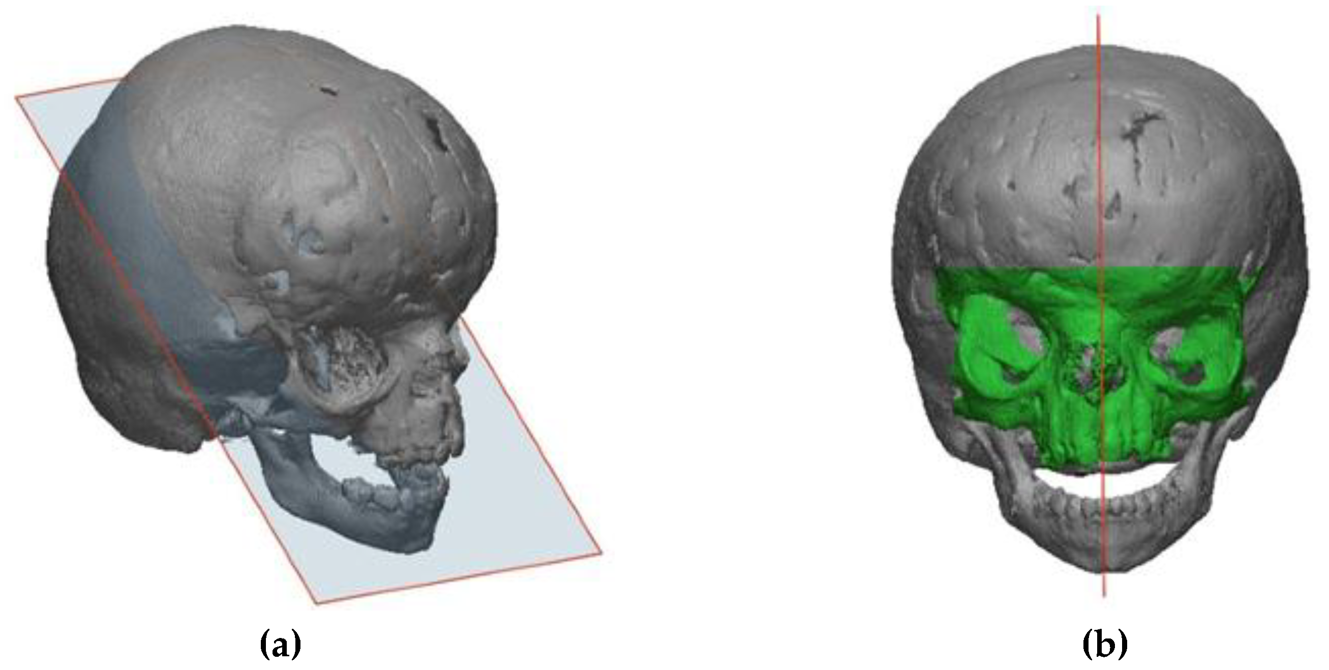 Symmetry 11 00245 g008 Symmetry 11 00245 g008