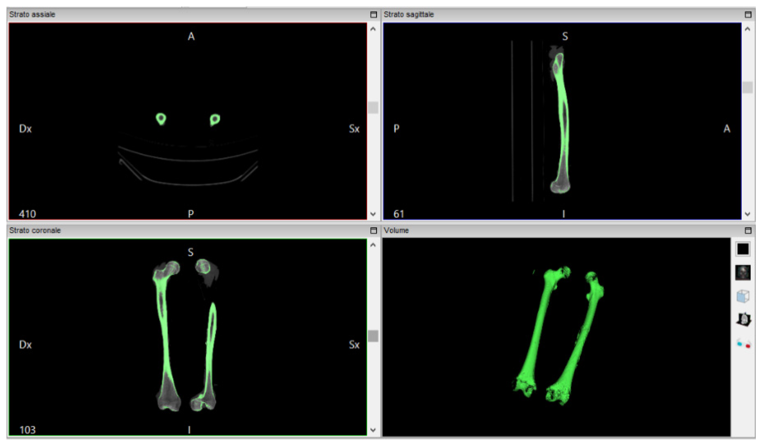 Symmetry 11 00542 g004