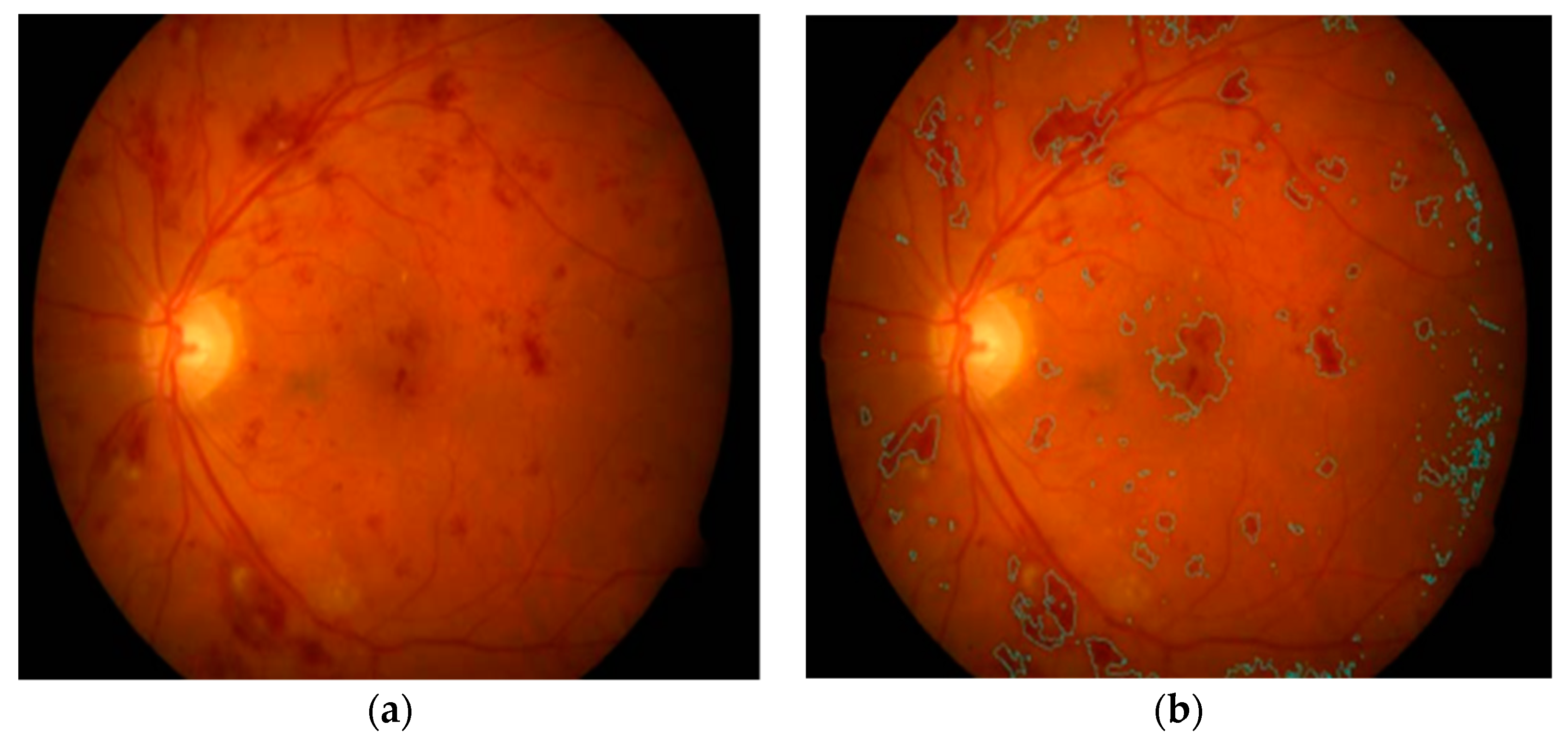 Symmetry 11 00749 g007