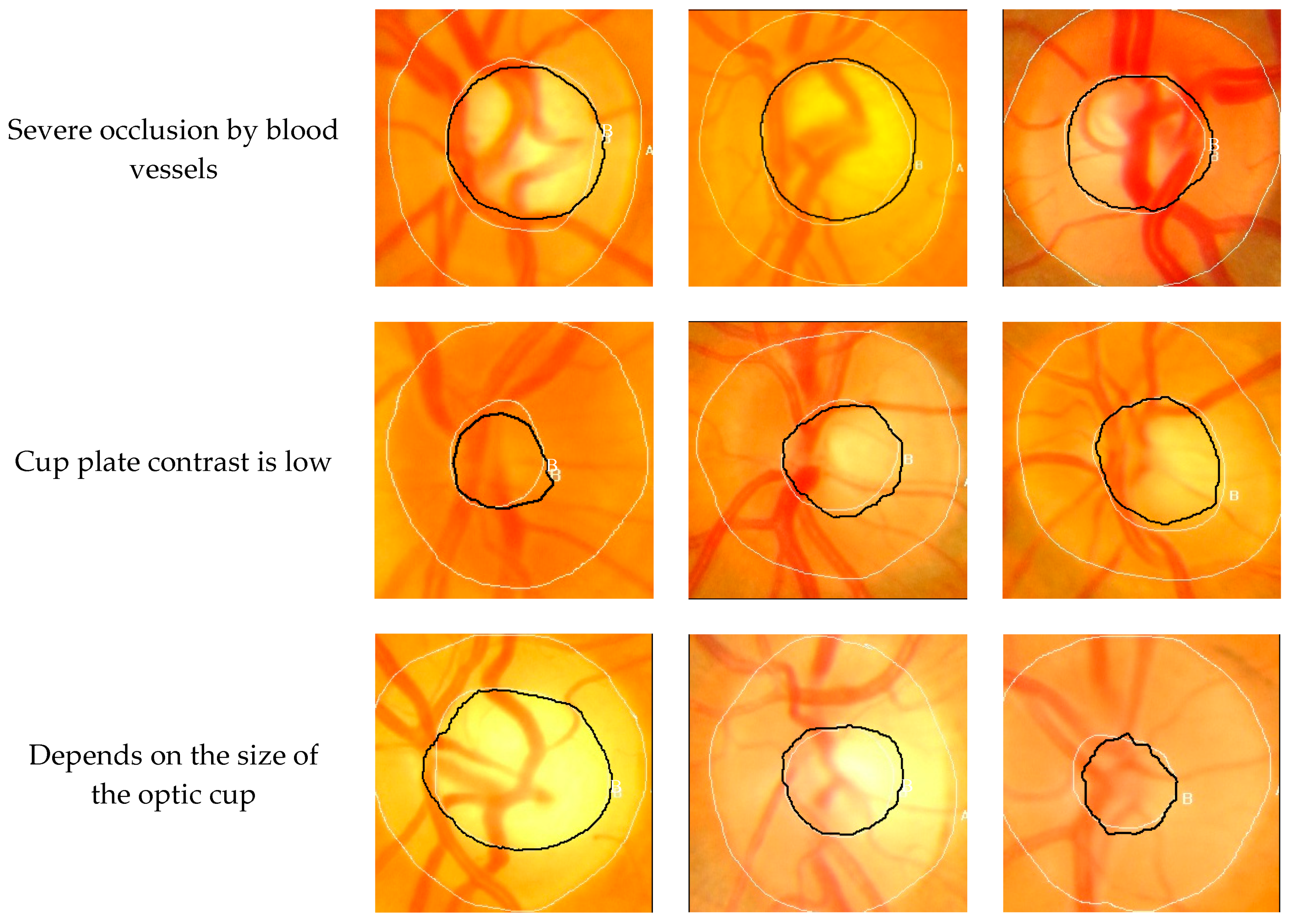 Symmetry 11 00933 g006 550