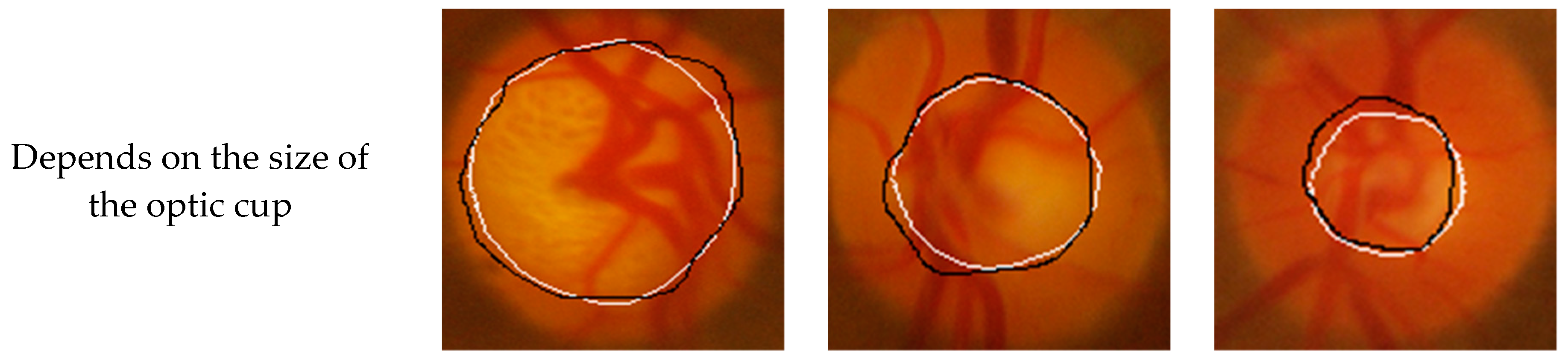 Symmetry 11 00933 g007b 550