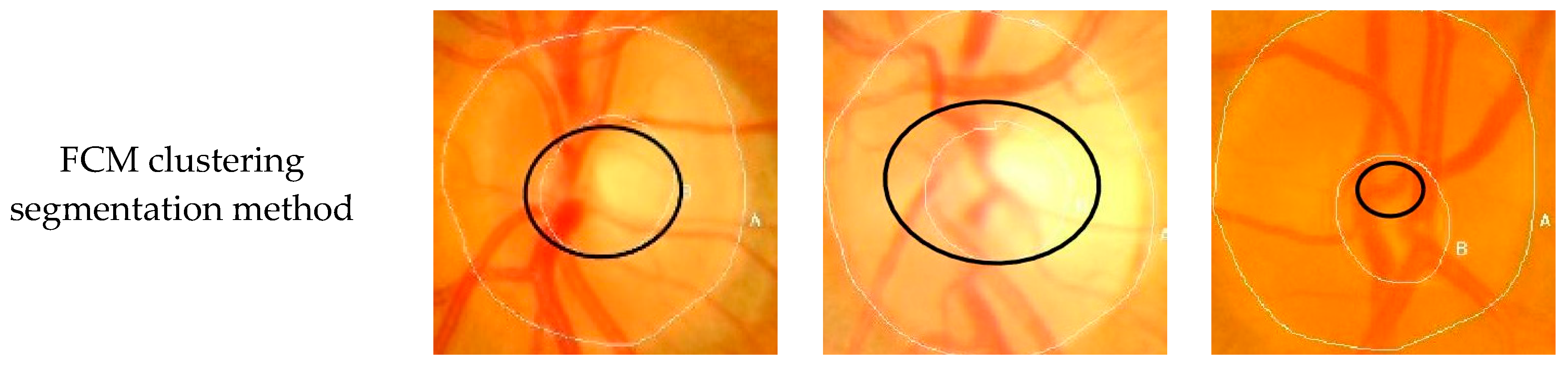Symmetry 11 00933 g009a 550