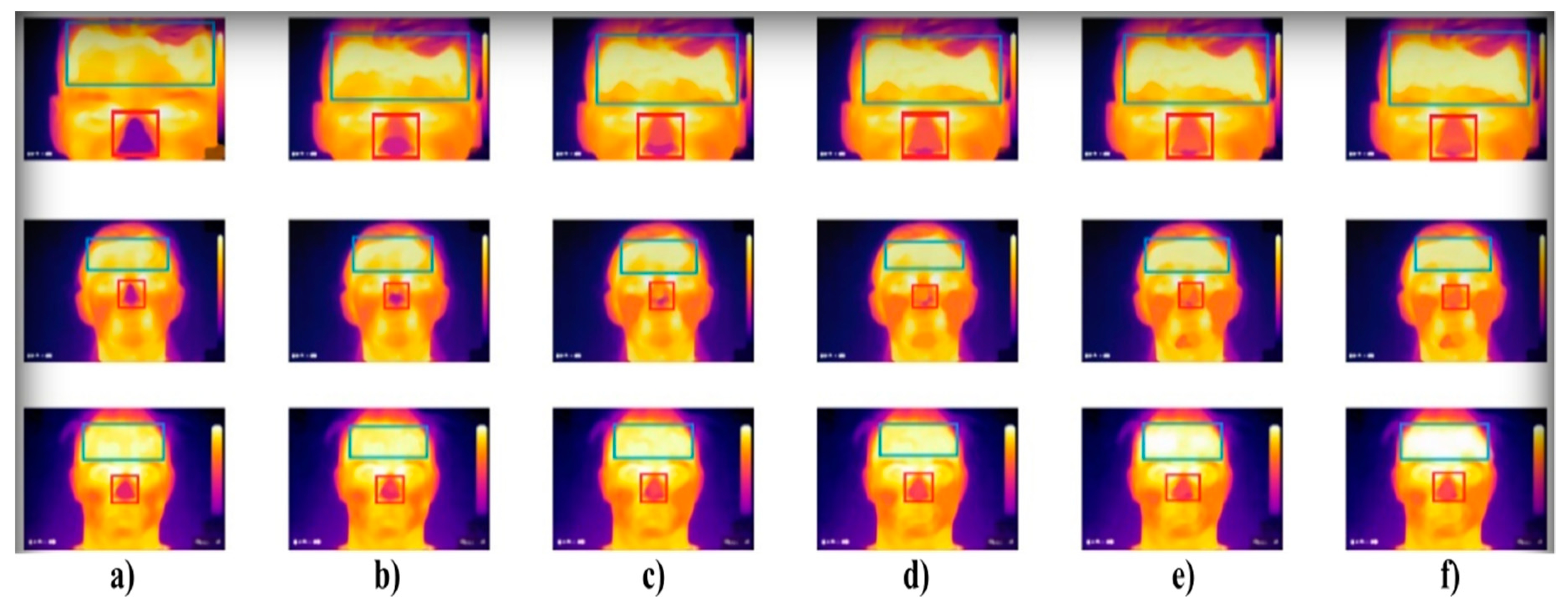 Symmetry 11 00995 g001