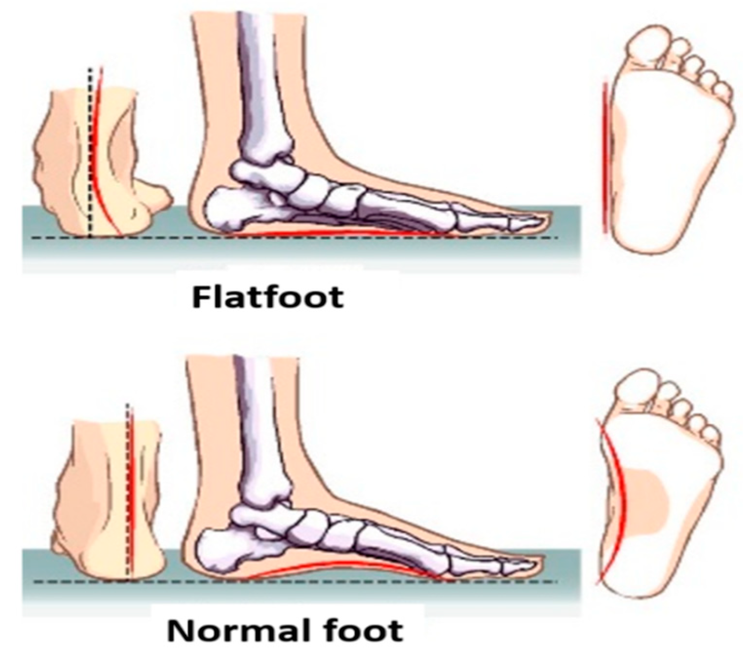 Symmetry 11 01317 g002 550