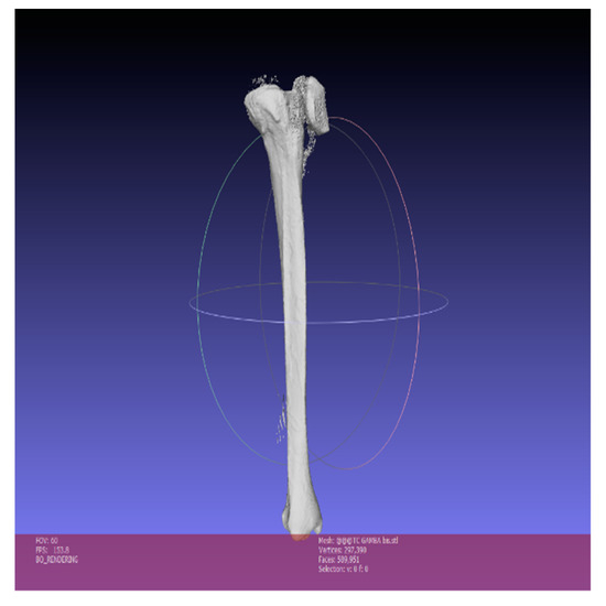 Symmetry Free Full Text Paediatric Orthopaedic Surgery With 3d Printing Improvements And Cost Reduction Html