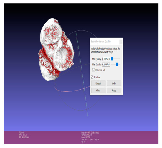 Symmetry Free Full Text Paediatric Orthopaedic Surgery With 3d Printing Improvements And Cost Reduction Html