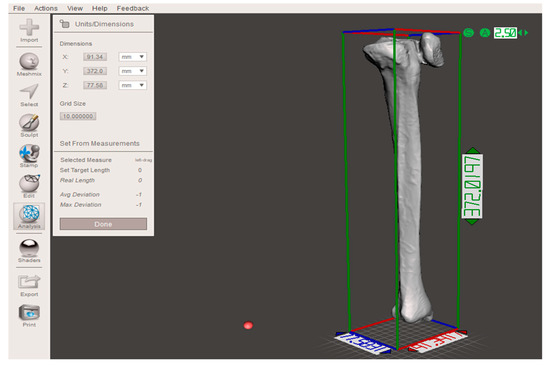 Symmetry Free Full Text Paediatric Orthopaedic Surgery With 3d Printing Improvements And Cost Reduction Html