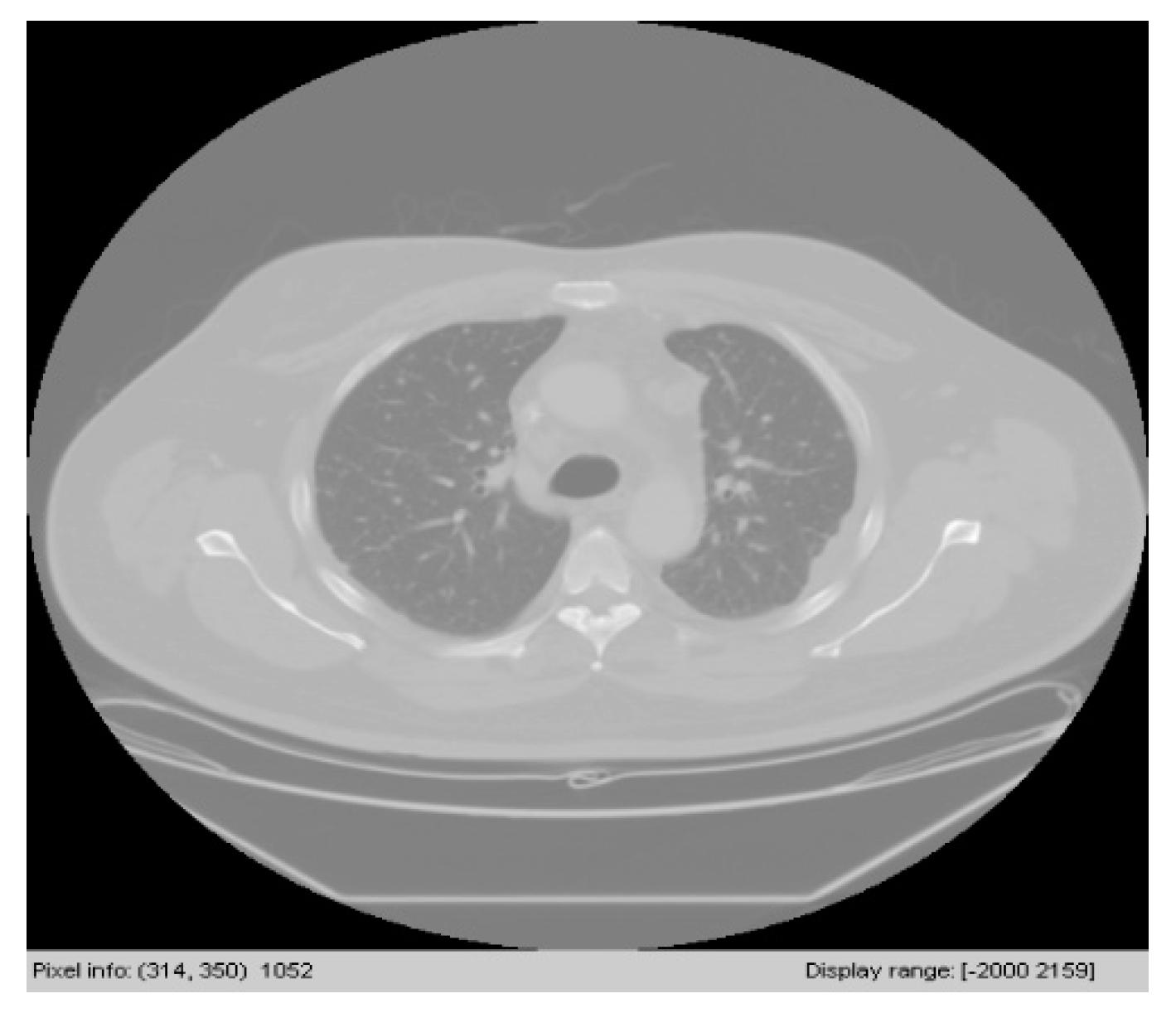 Symmetry 12 00386 g004