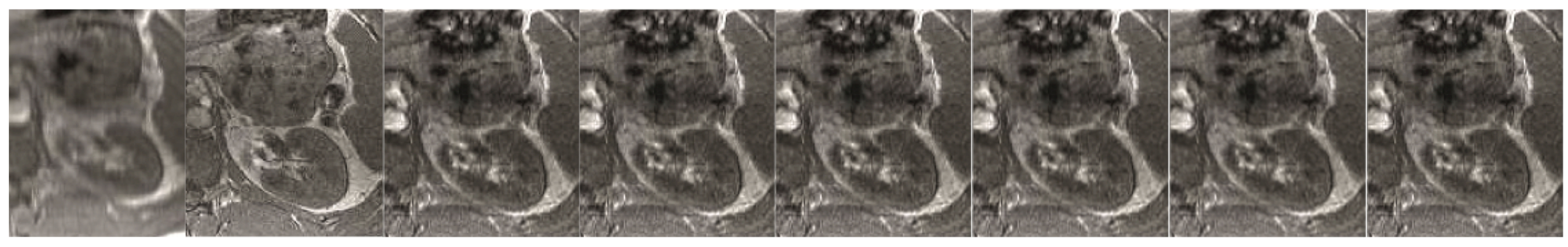 Symmetry 12 00681 g008